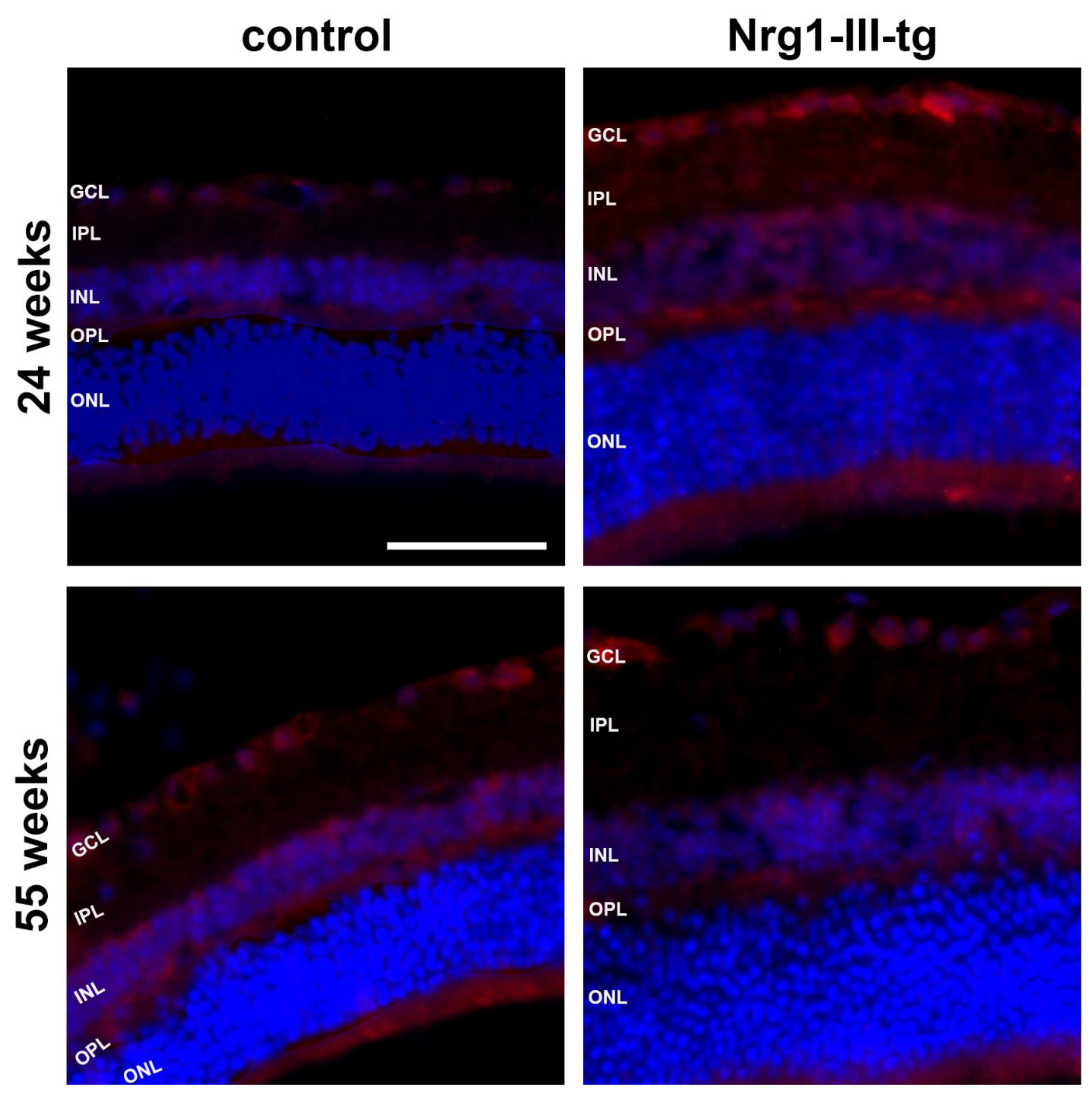 Ijms 23 04489 g005 550