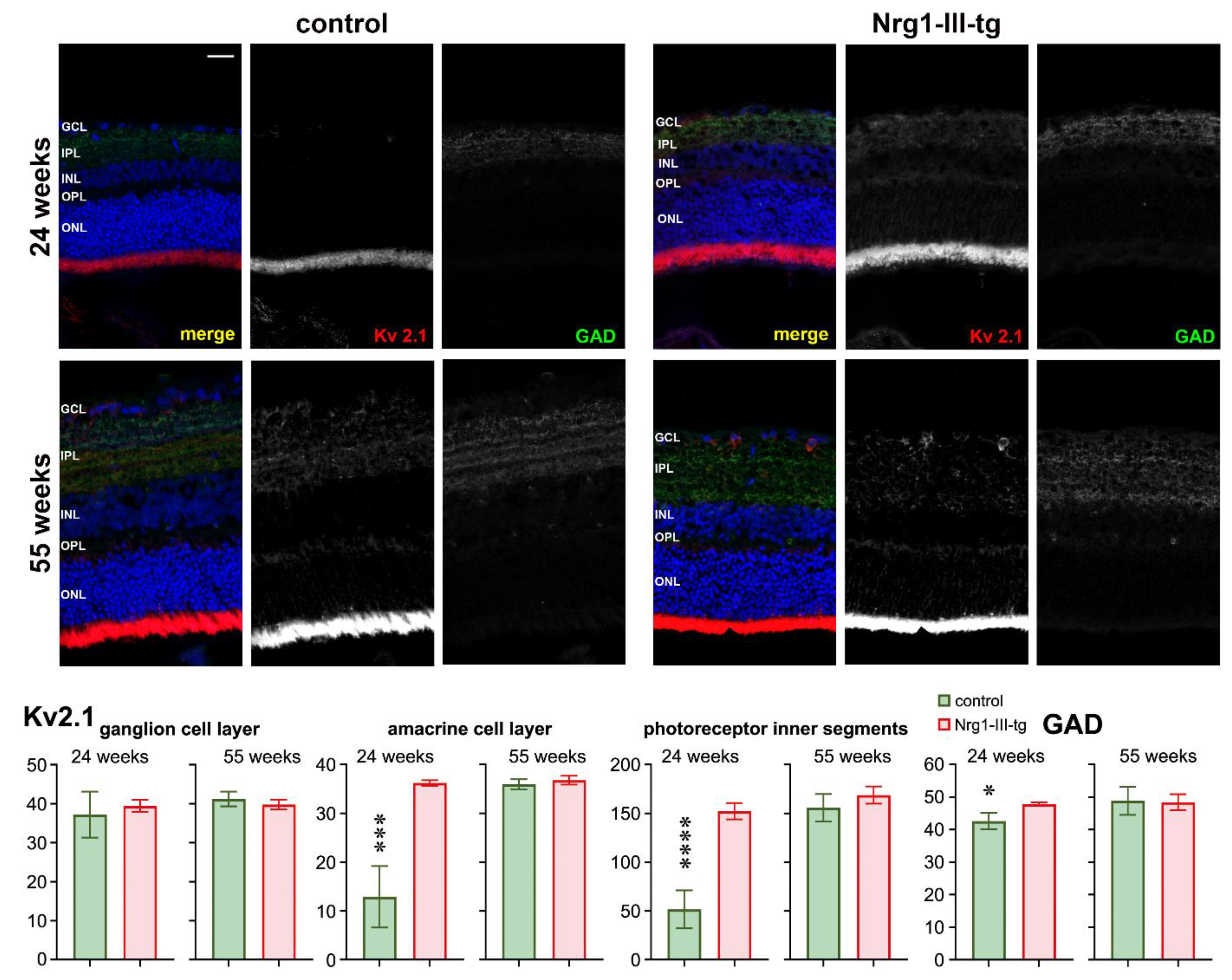 Ijms 23 04489 g006 550