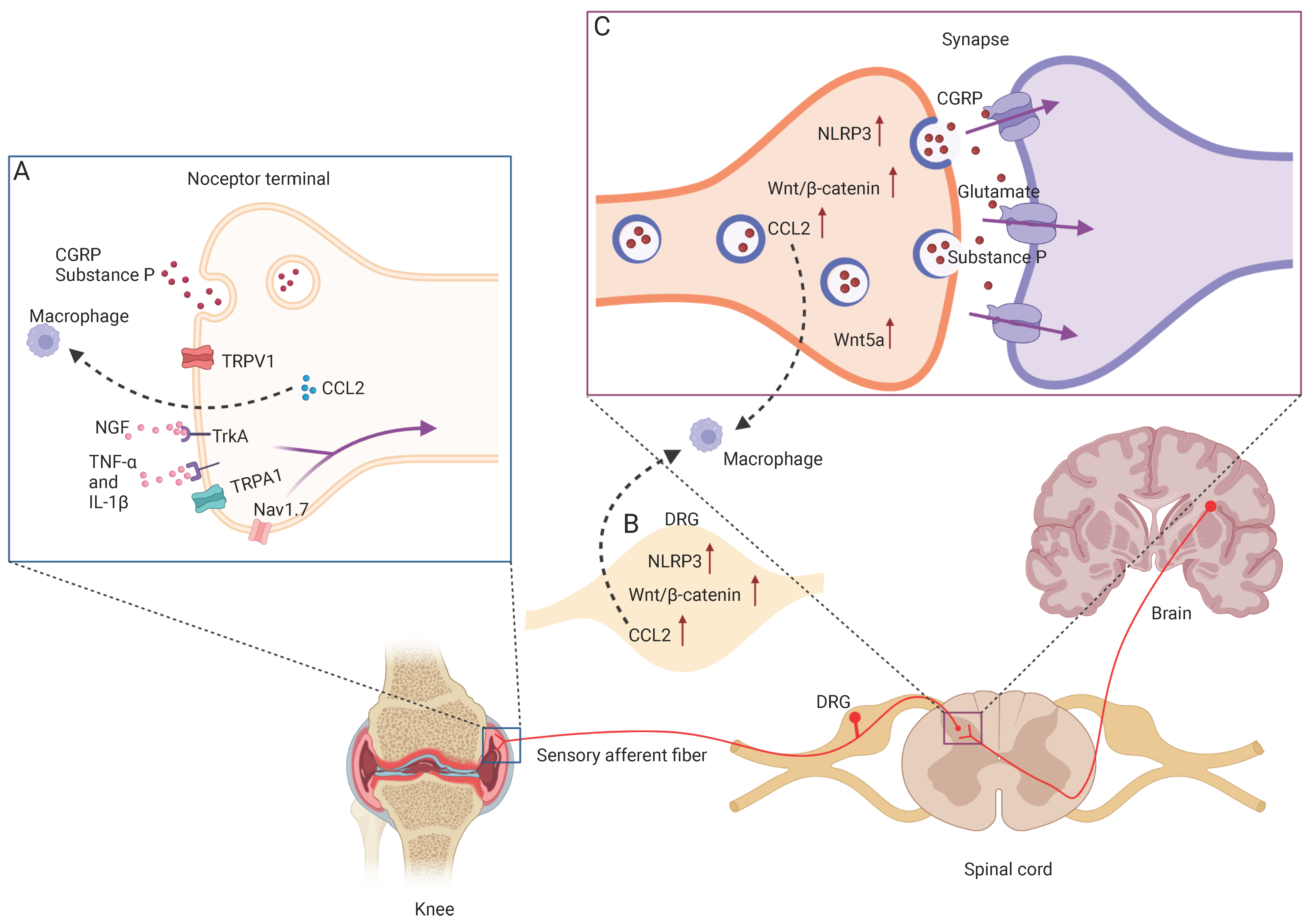 IJMS | Free Full-Text | Osteoarthritis Pain IJMS | Free Full-Text | Osteoarthritis Pain