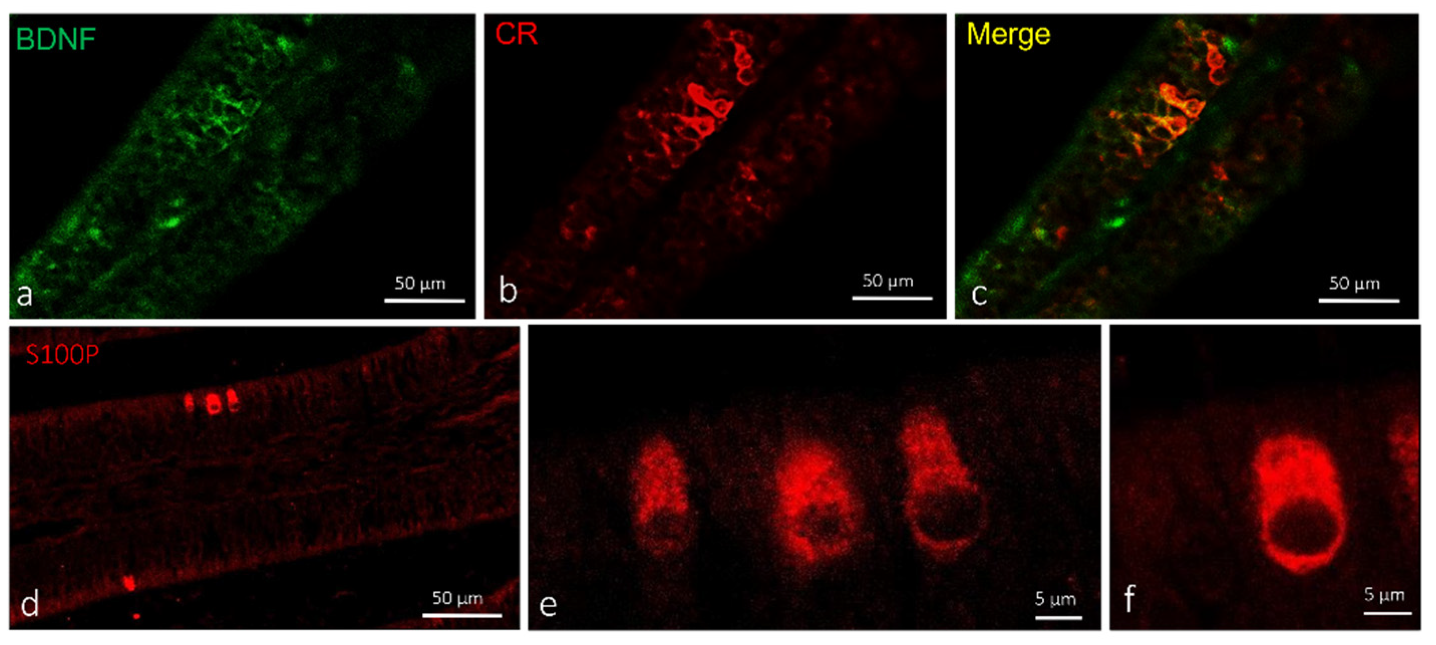 Ijms 23 04696 g004 Ijms 23 04696 g004
