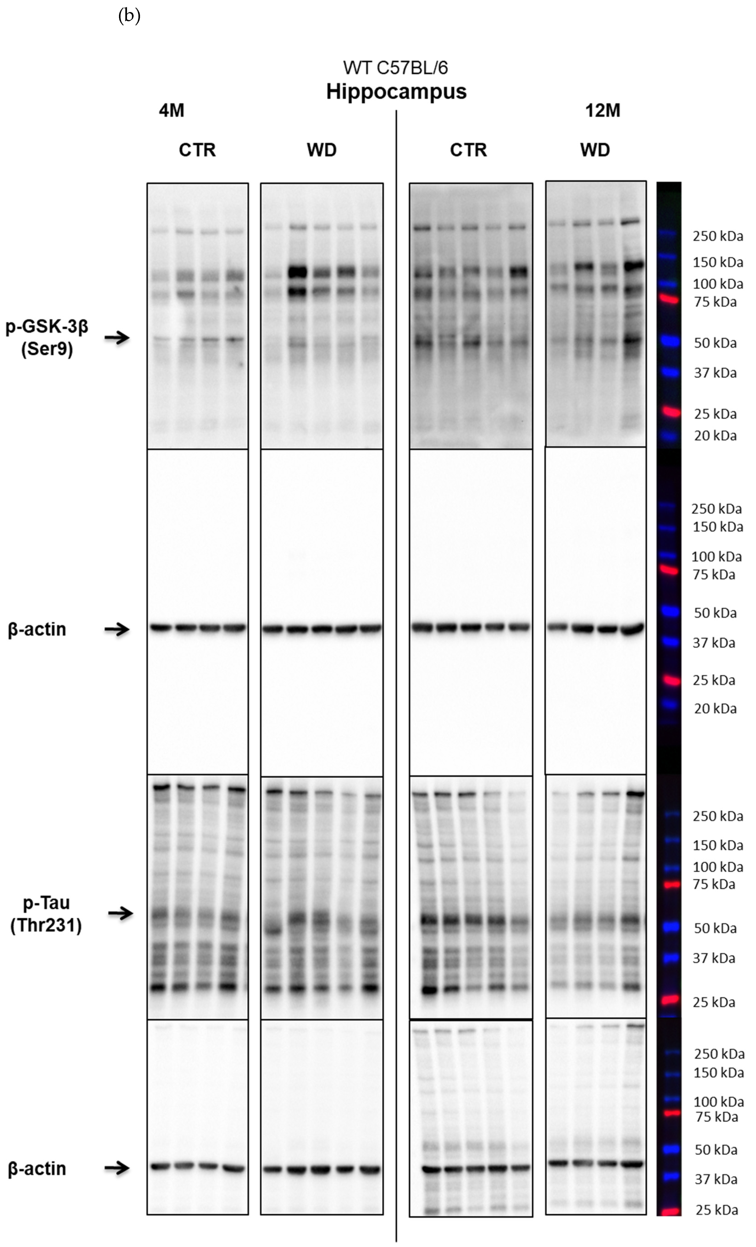Ijms 23 04744 g0a2b Ijms 23 04744 g0a2b