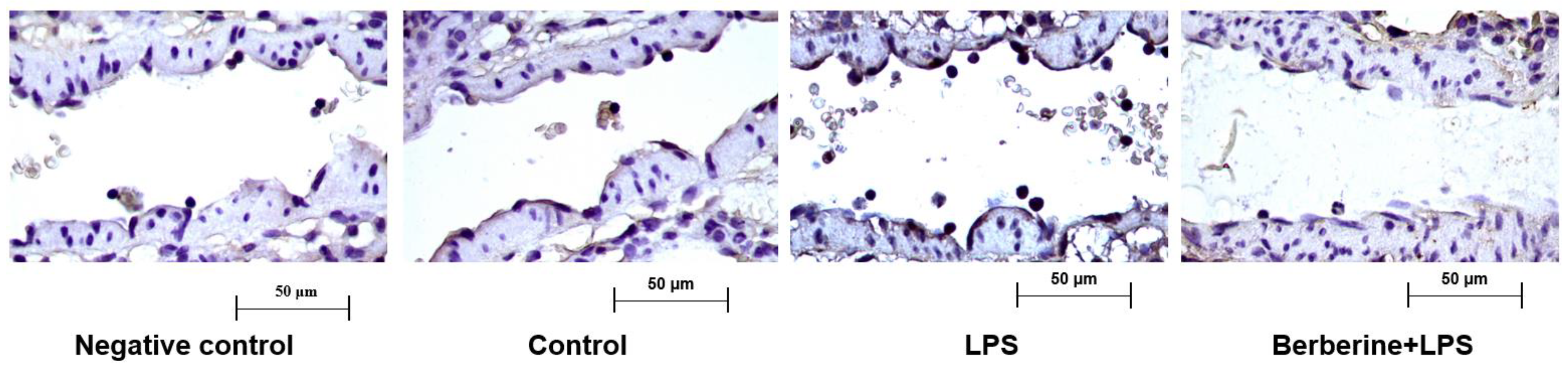 Ijms 23 04801 g001 550