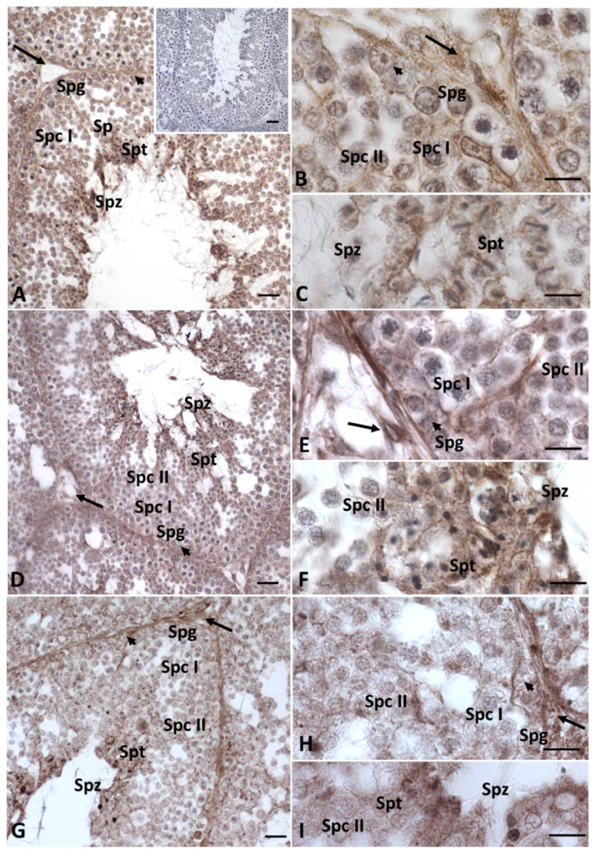 Ijms 23 04850 g005 550