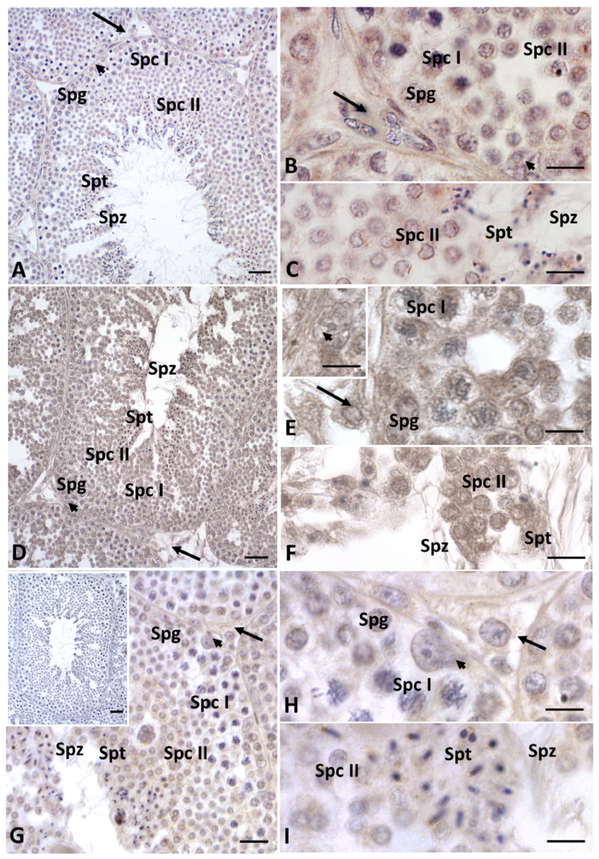 Ijms 23 04850 g006 550