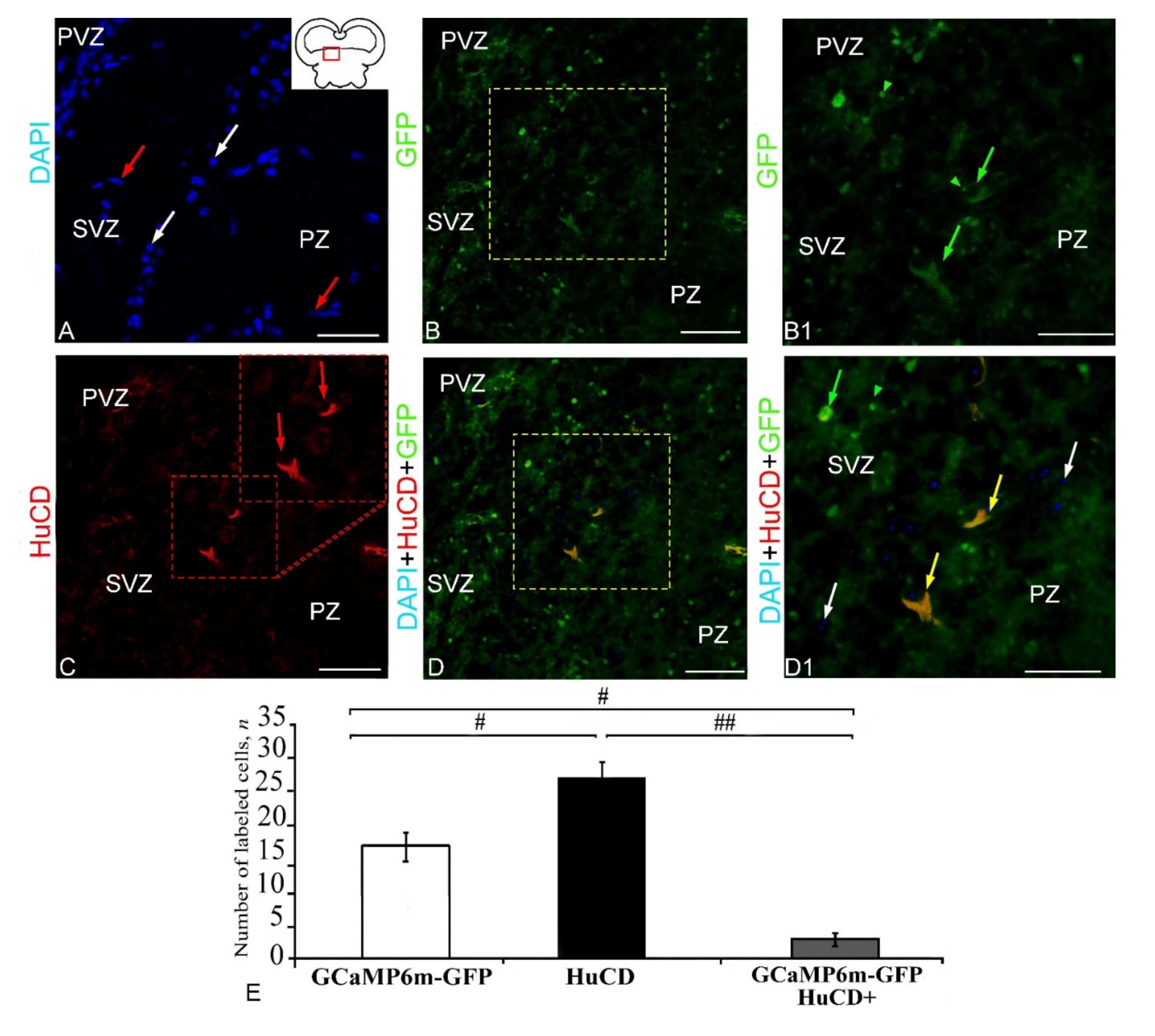 Ijms 23 04947 g007 Ijms 23 04947 g007