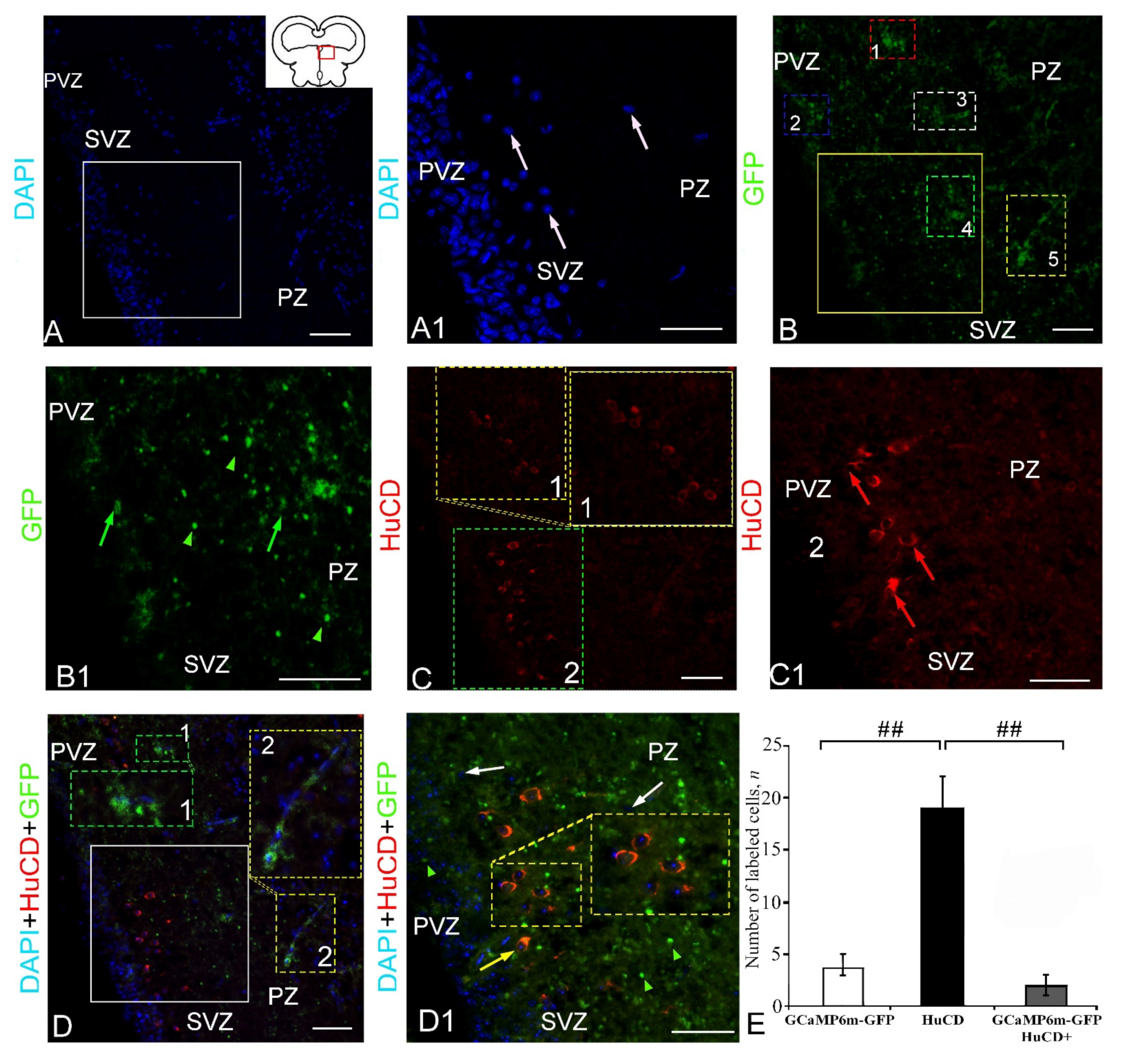 Ijms 23 04947 g008 Ijms 23 04947 g008