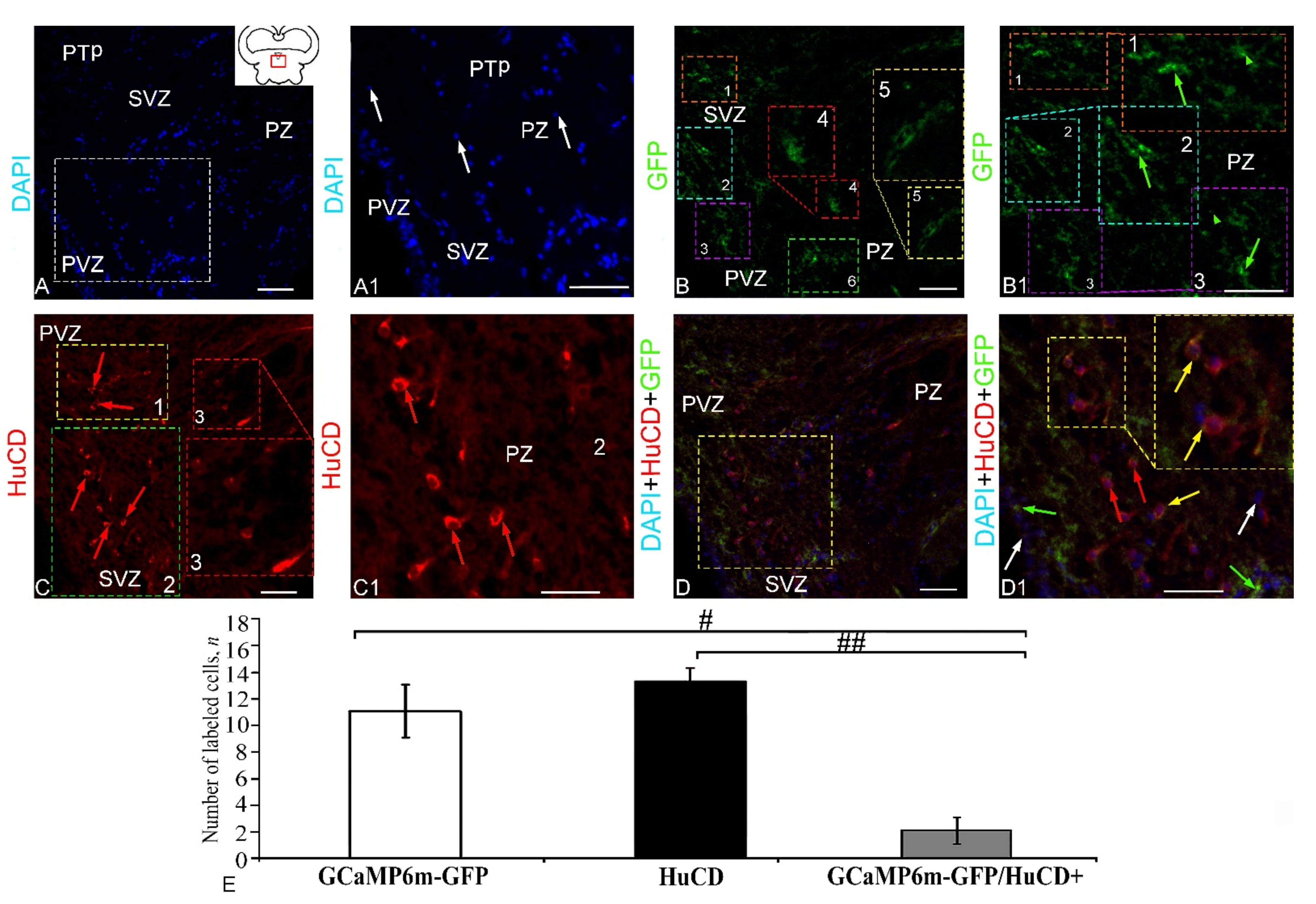 Ijms 23 04947 g010 Ijms 23 04947 g010