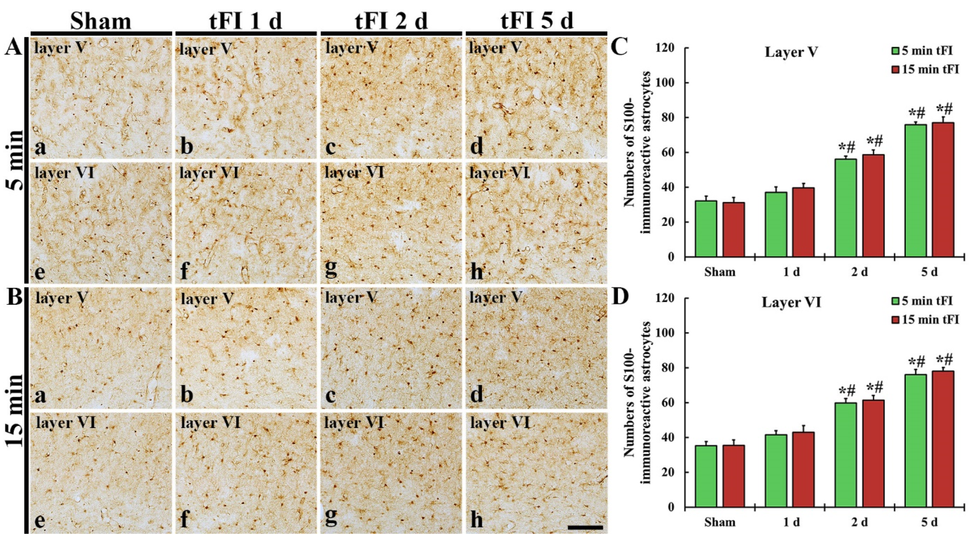 buyer Department Mail IJMS | Free Full-Text | Relationship between Neuronal Damage/Death and Astrogliosis in the Cerebral Motor Cortex of Gerbil Models of Mild and Severe Ischemia and Reperfusion Injury | HTML buyer Department Mail IJMS | Free Full-Text | Relationship between Neuronal Damage/Death and Astrogliosis in the Cerebral Motor Cortex of Gerbil Models of Mild and Severe Ischemia and Reperfusion Injury | HTML