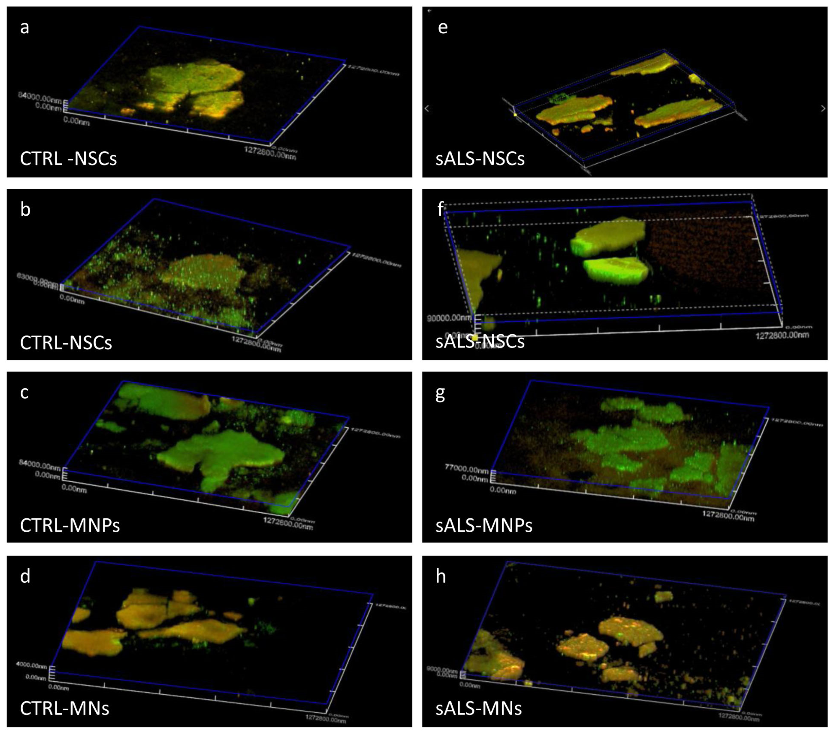 Patients' Stem Cells Differentiation in a 3D Environment as