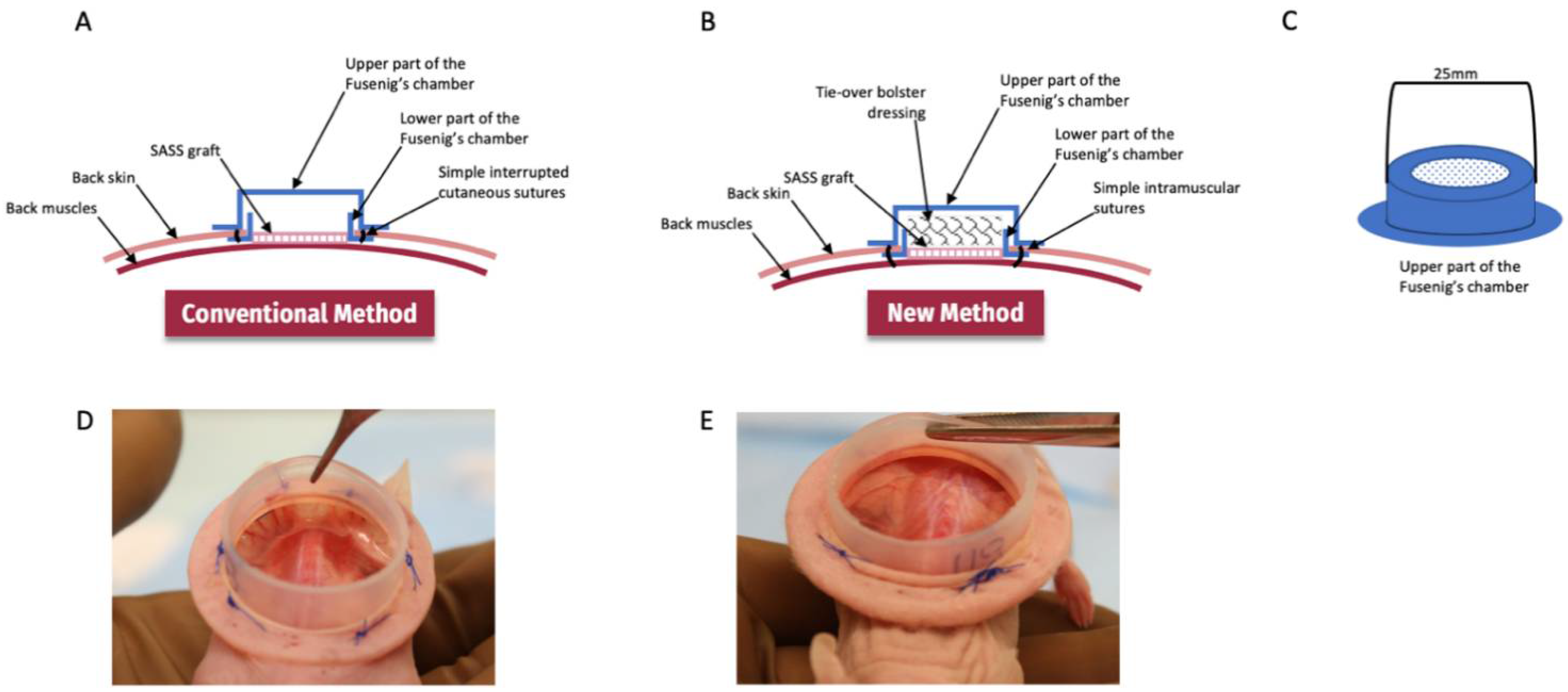 Bolster clearance medical definition