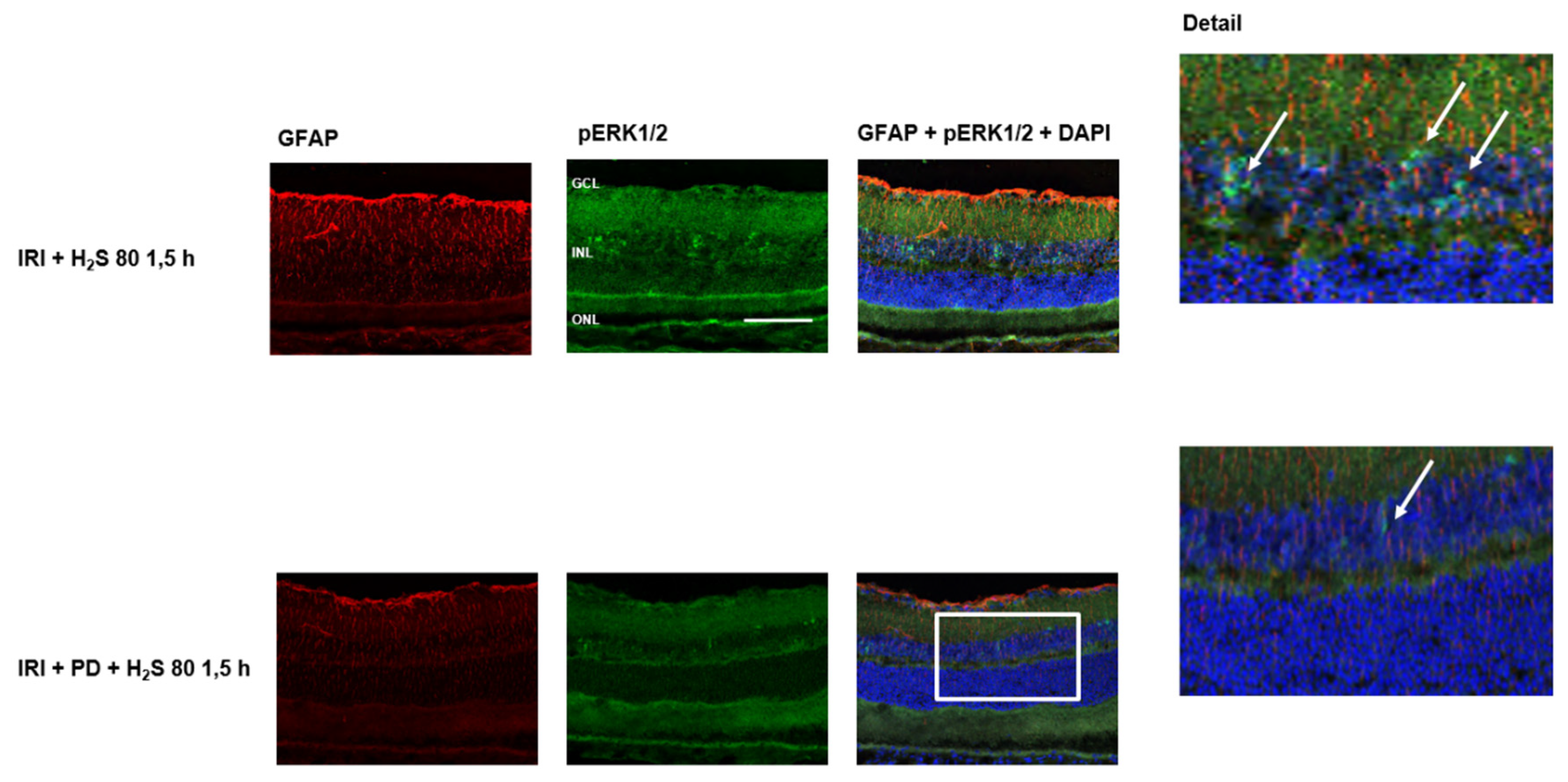 Ijms 23 05519 g009 550
