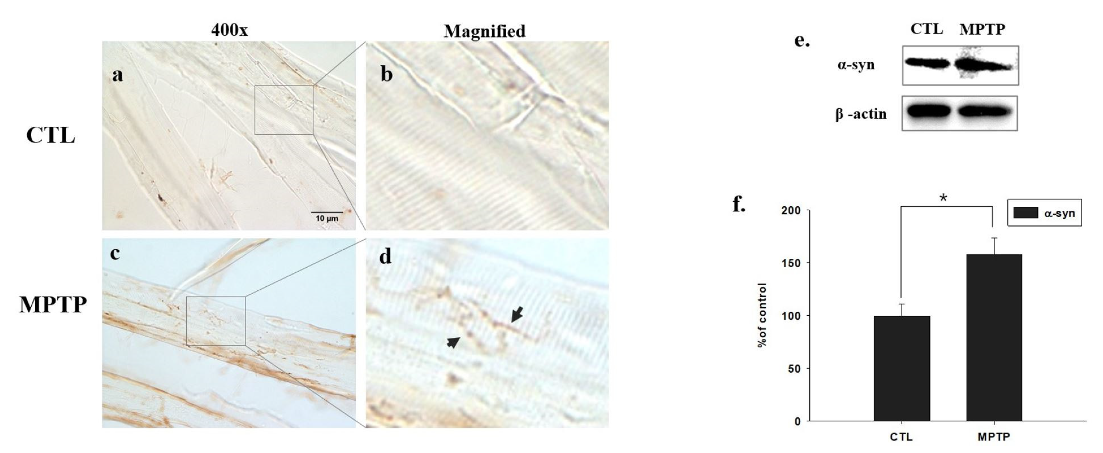 Ijms 23 05646 g003 550