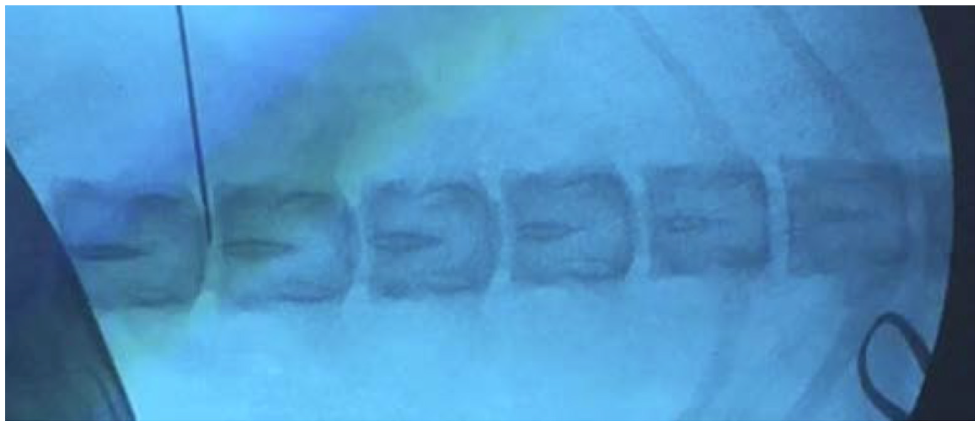 Ijms 23 05717 g001 550