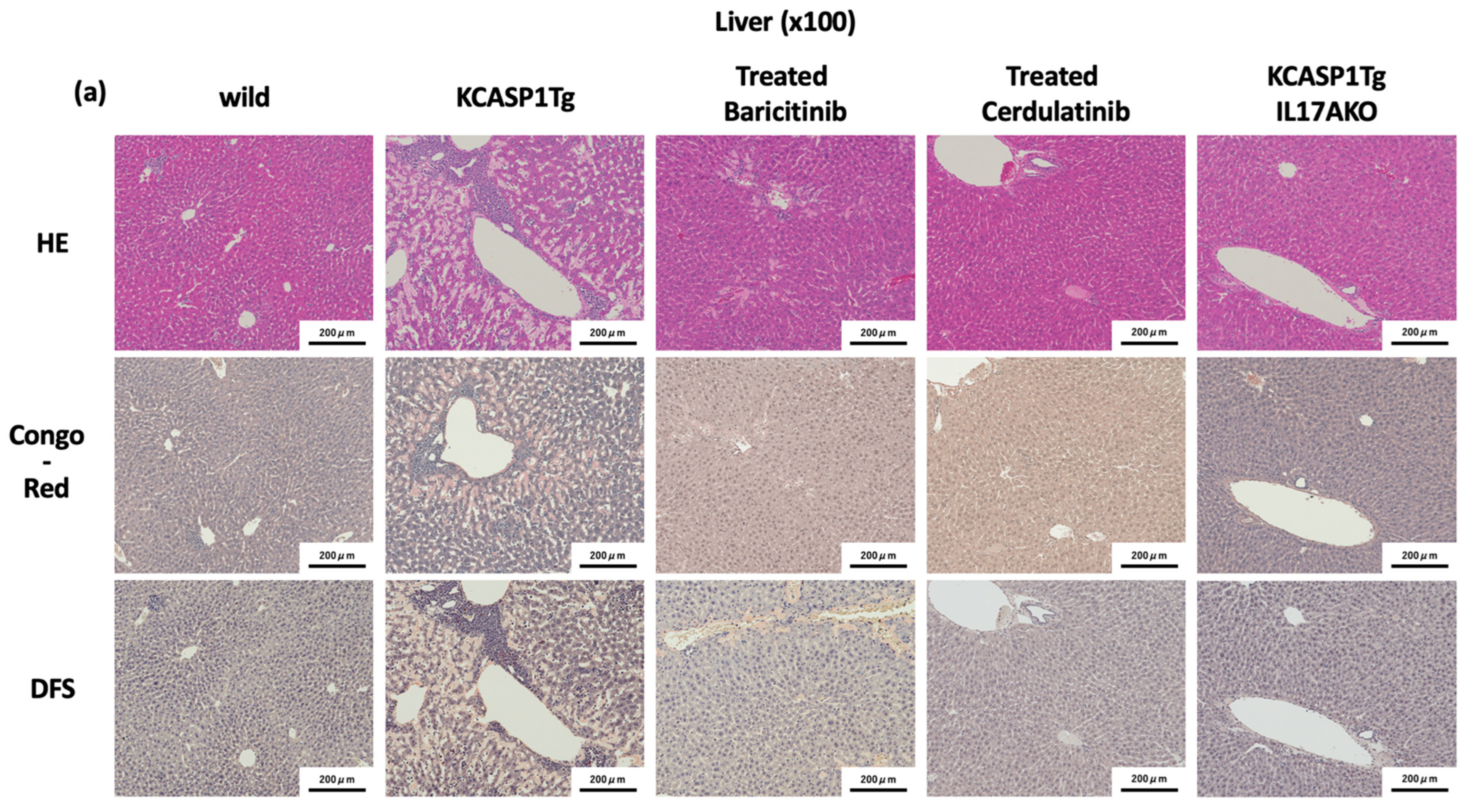 Ijms 23 05726 g004a 550