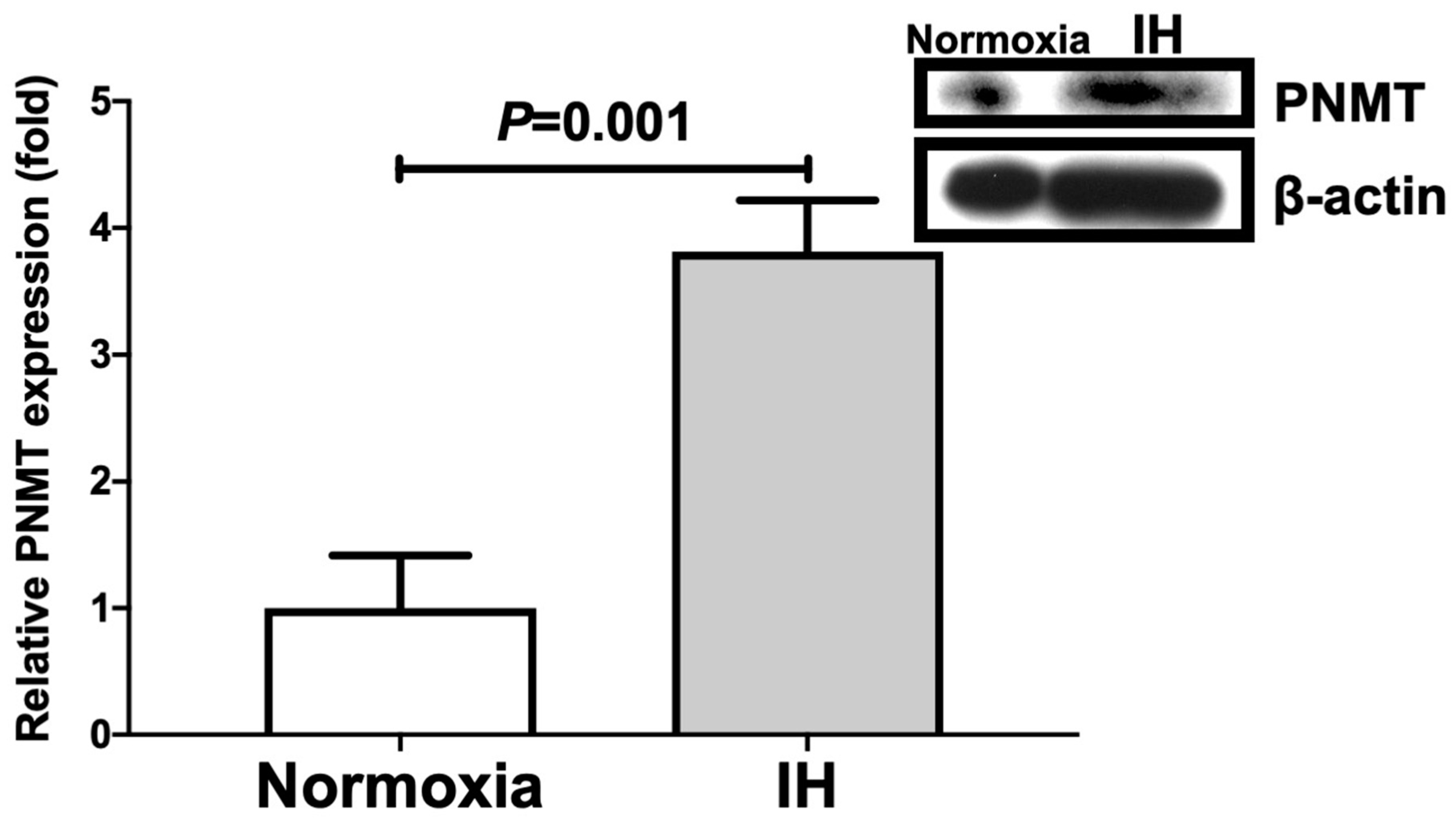 Ijms 23 05868 g004 Ijms 23 05868 g004