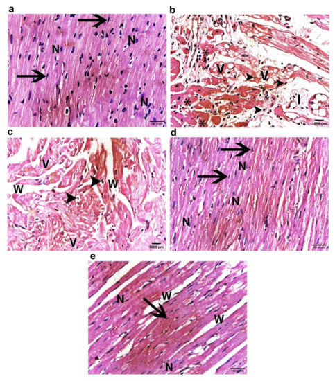 N・_・N Zoro Select Flexible Extension, 1/4