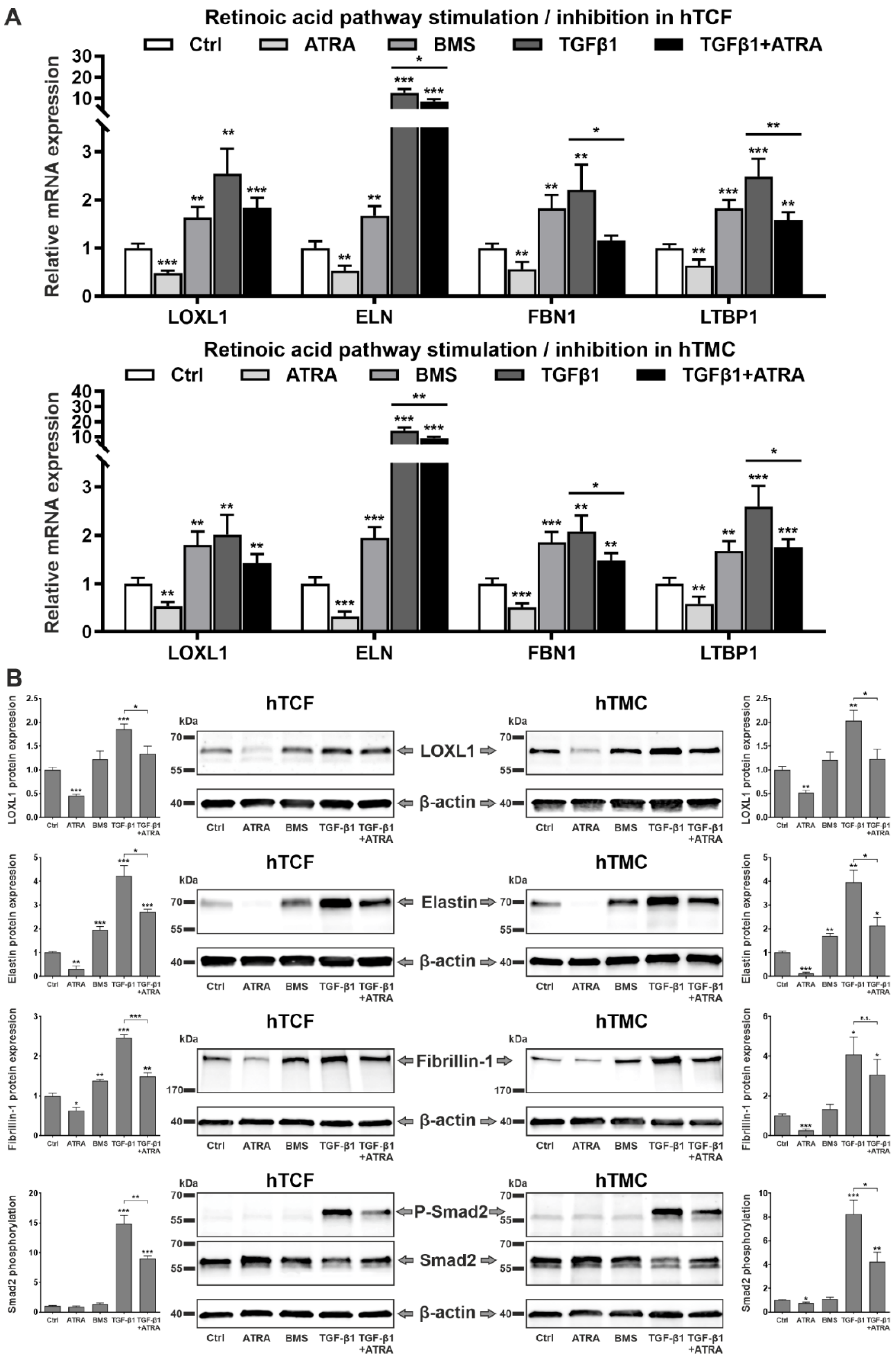 Ijms 23 05977 g008 550