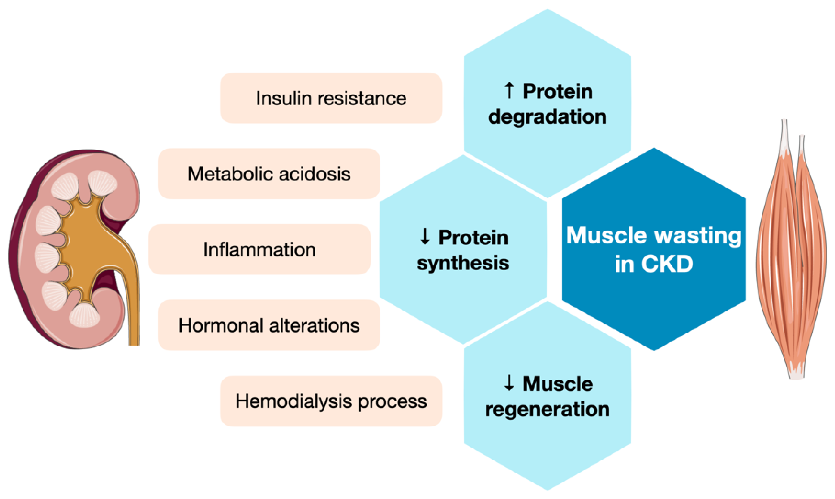 Causes Of Atrophic Kidney causes-of-atrophic-kidney