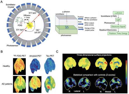 Neuroimaging Modalities in Alzheimer's Disease: Diagnosis