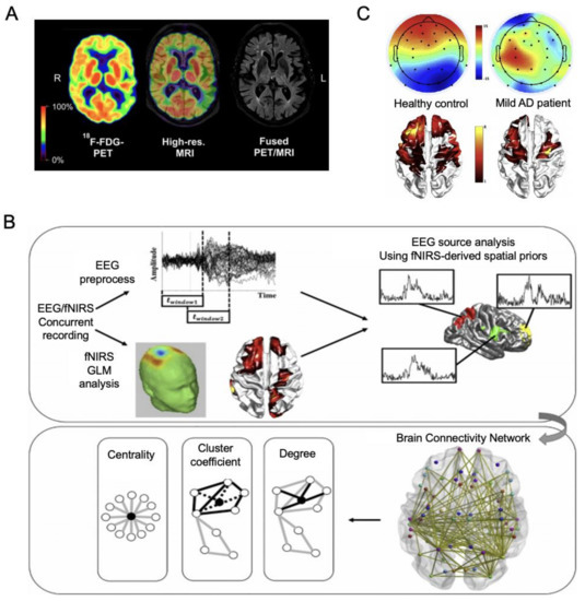 Frontiers | Diffusion Breast MRI: Current Standard and