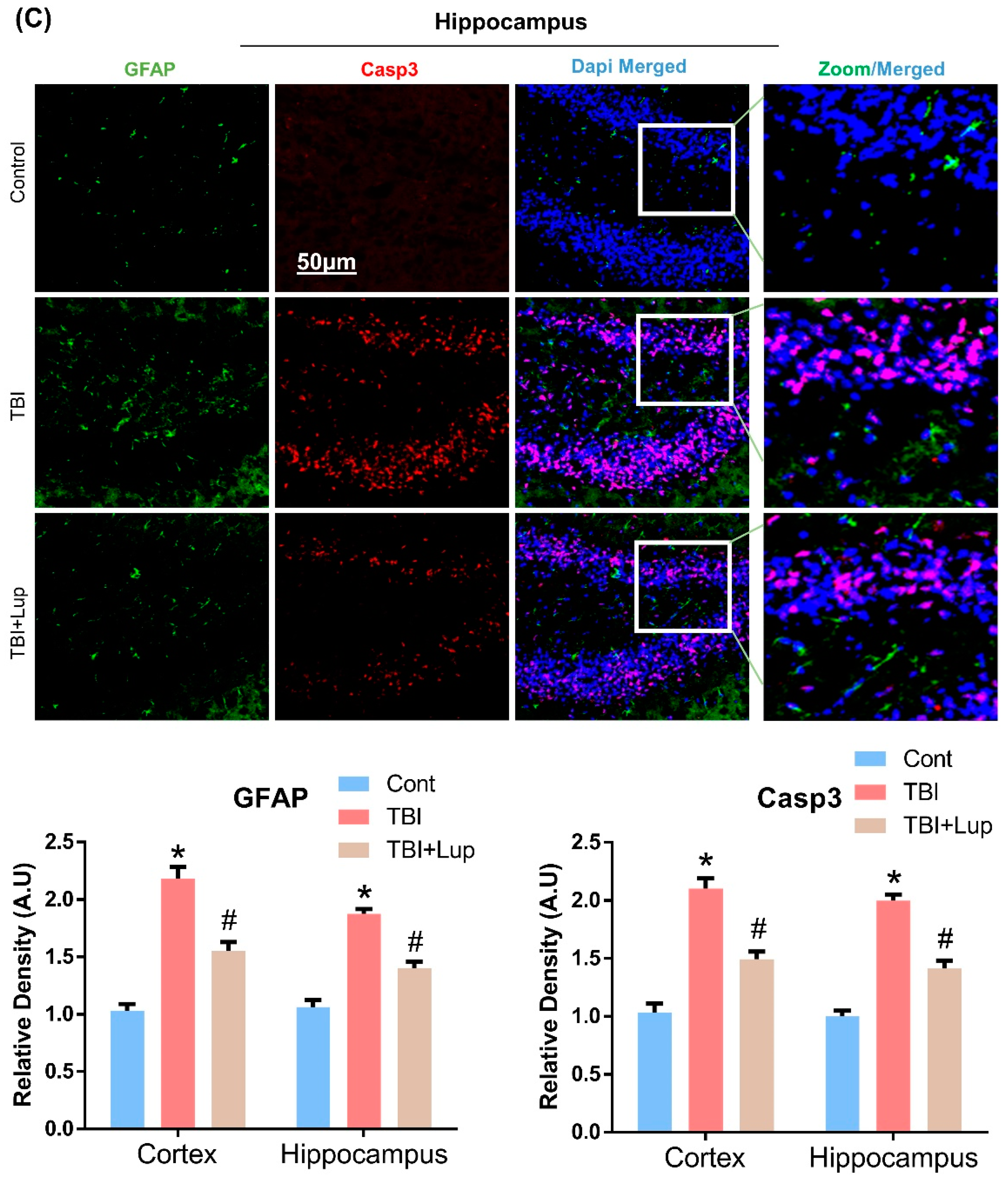 Ijms 23 06086 g004b Ijms 23 06086 g004b