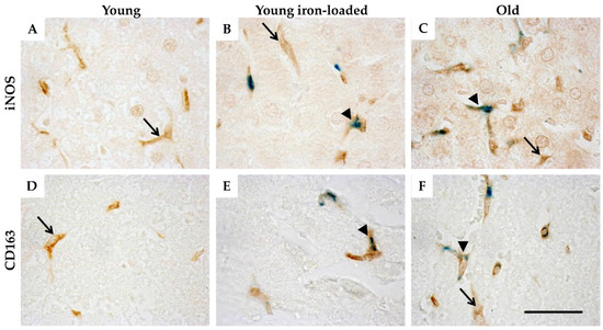 Hepatic Macrophage Abundance and Phenotype in Aging and Liver Iron ...