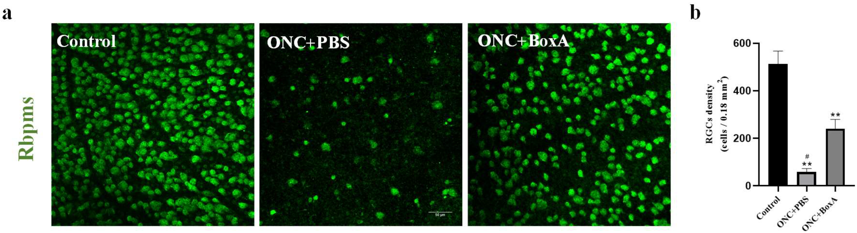 Ijms 23 06715 g004 550