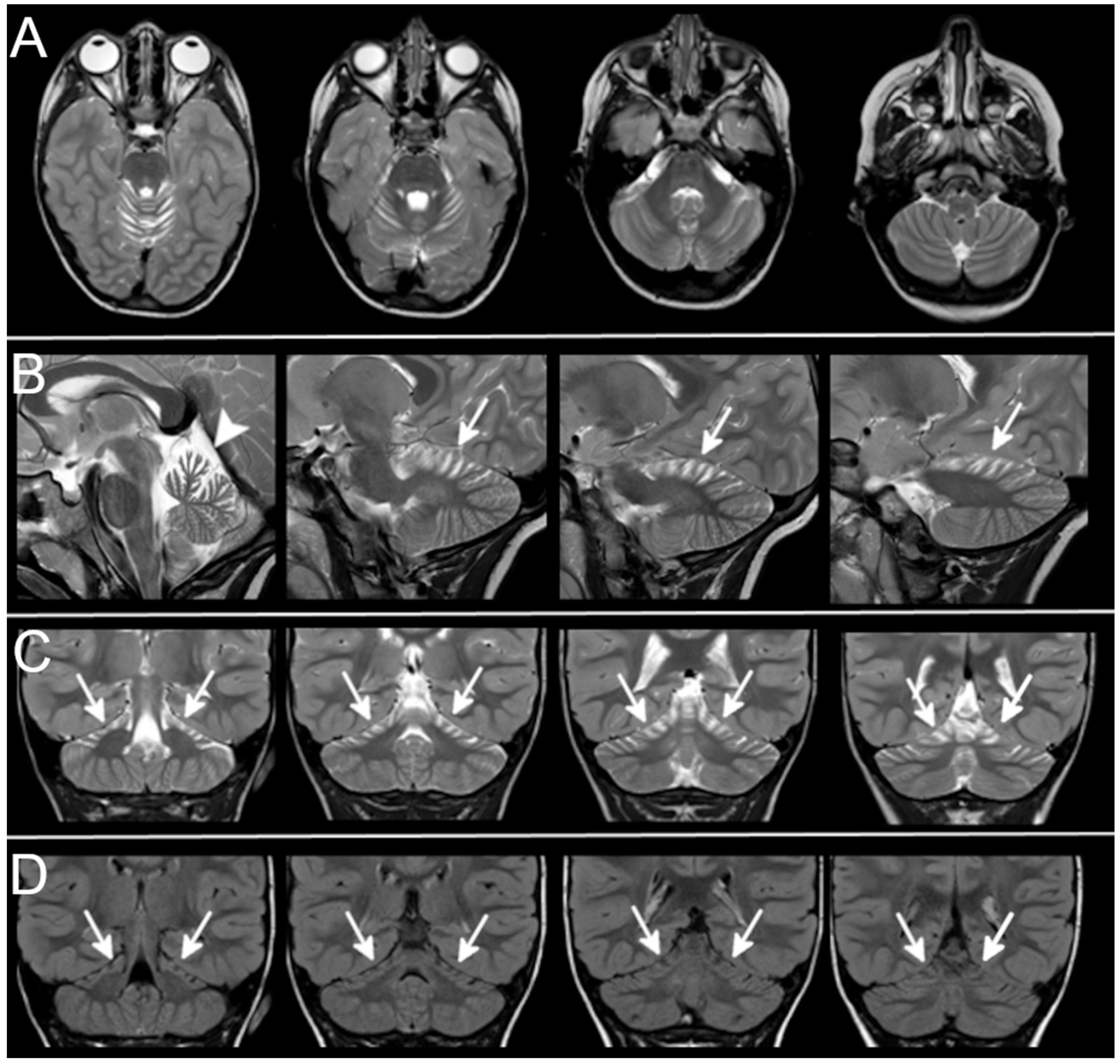 Ijms 23 06723 g002 550