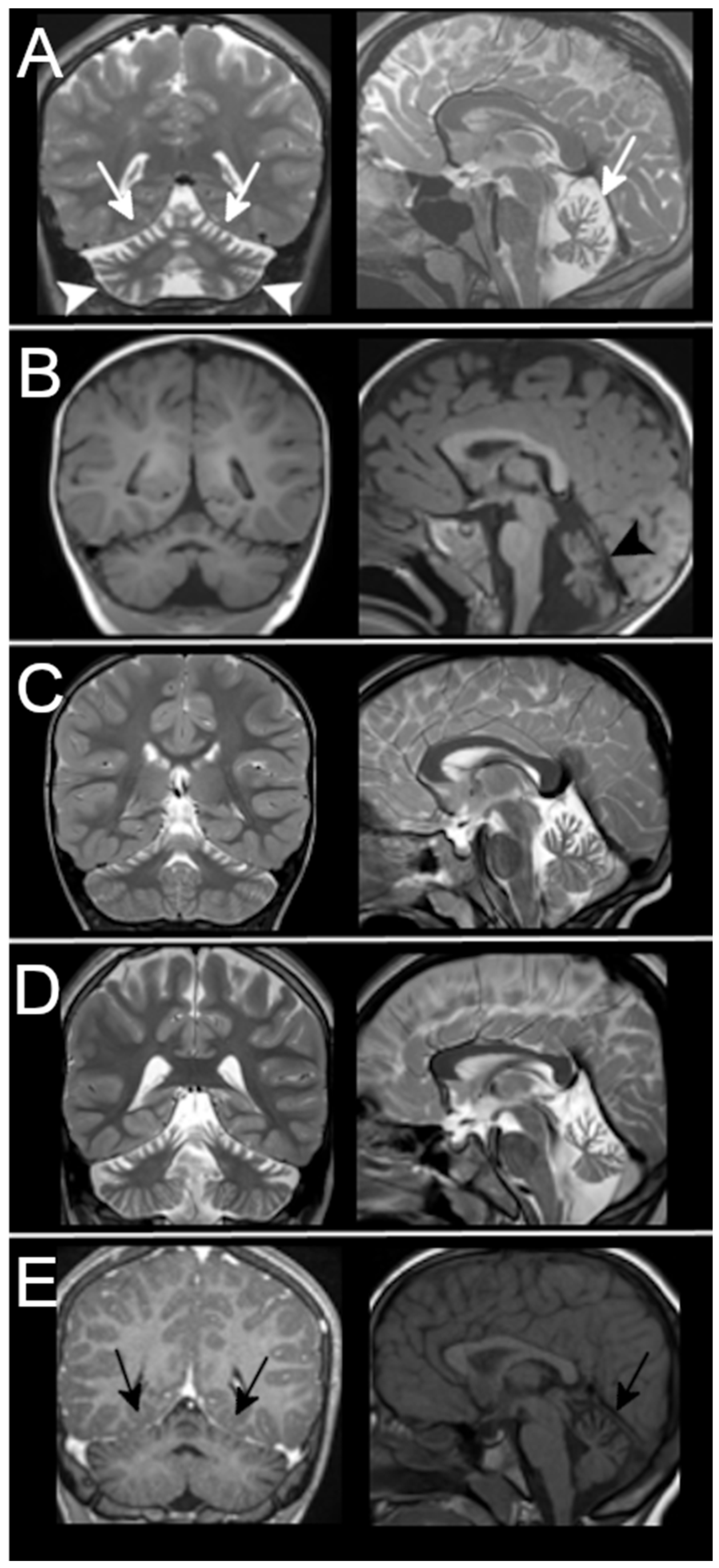 Ijms 23 06723 g004 550