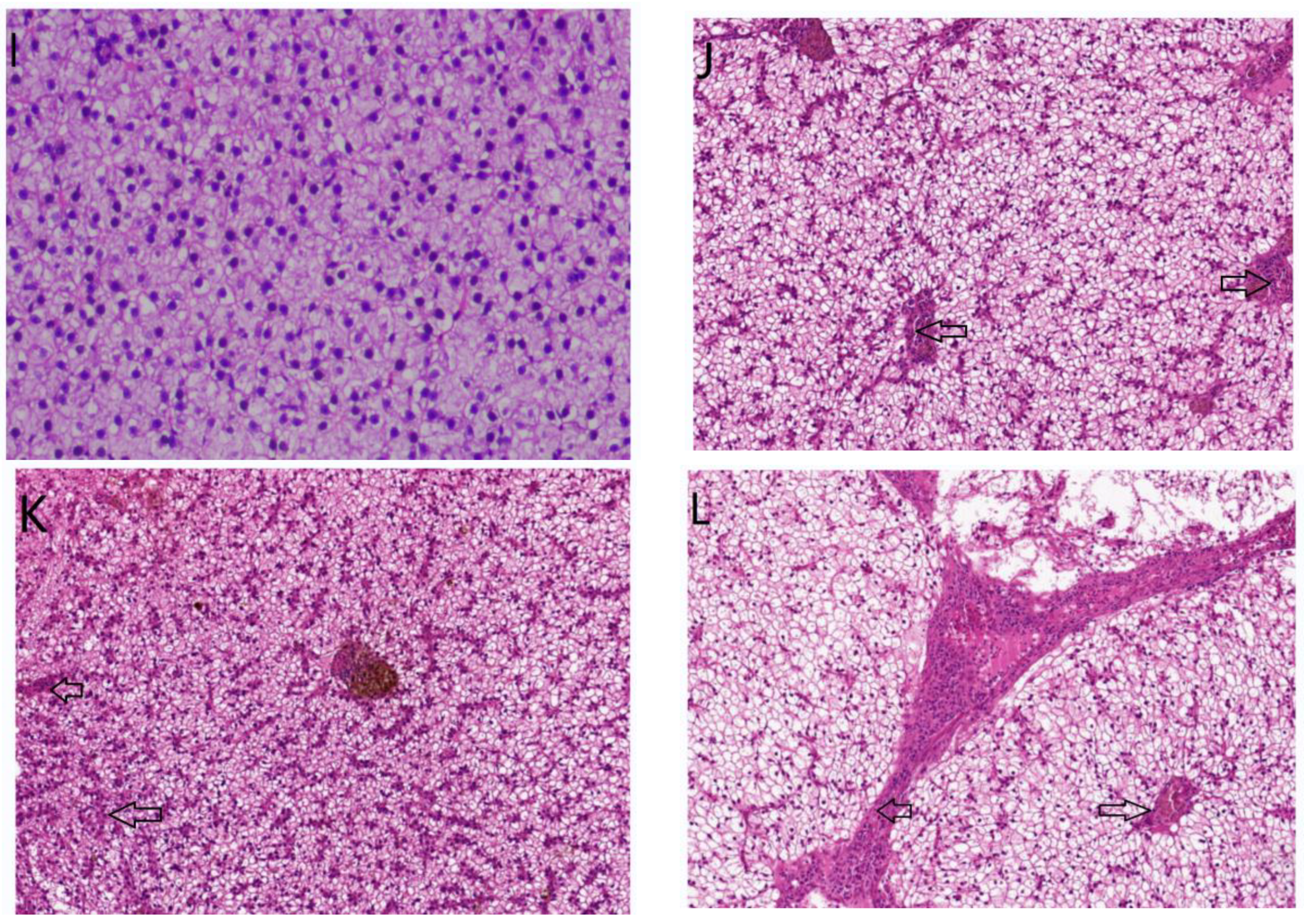 Ijms 23 06733 g009b 550