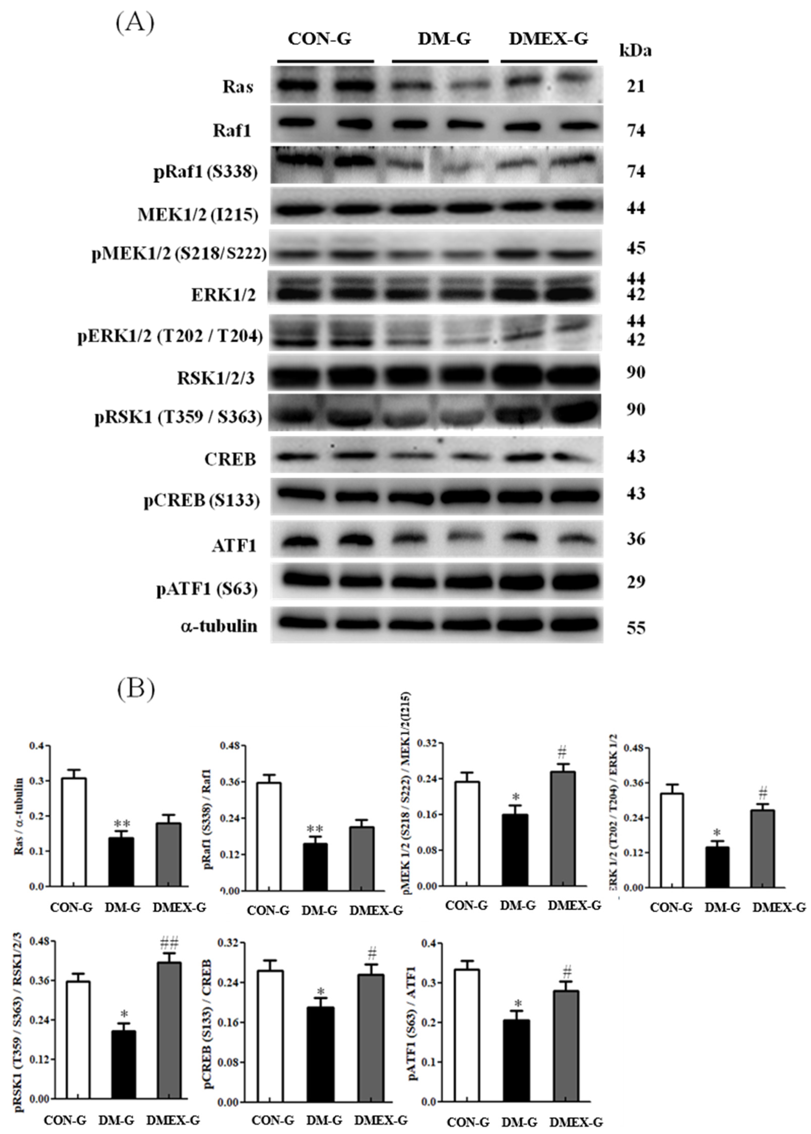 Ijms 23 06740 g005 550