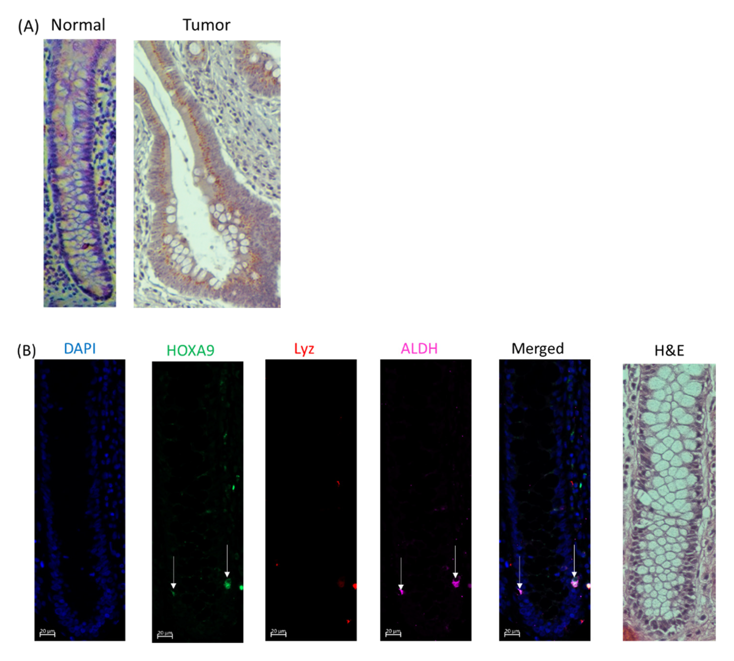 Colorectal Cancer in the Elderly [ハードカバー] Tan， Kok-Yang 41418_2021_828_Fig1_HTML.png