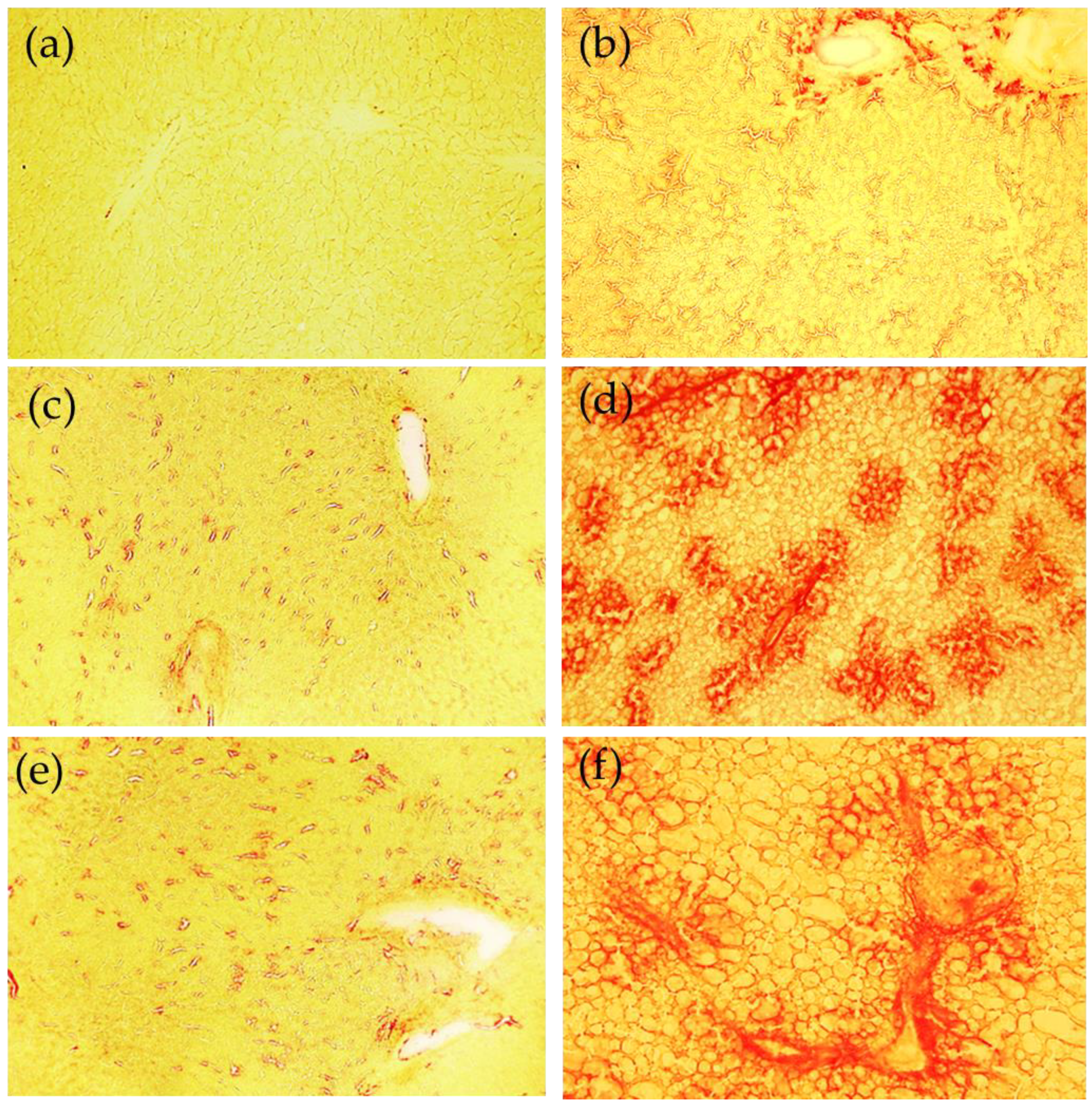 Ijms 23 06817 g004 550