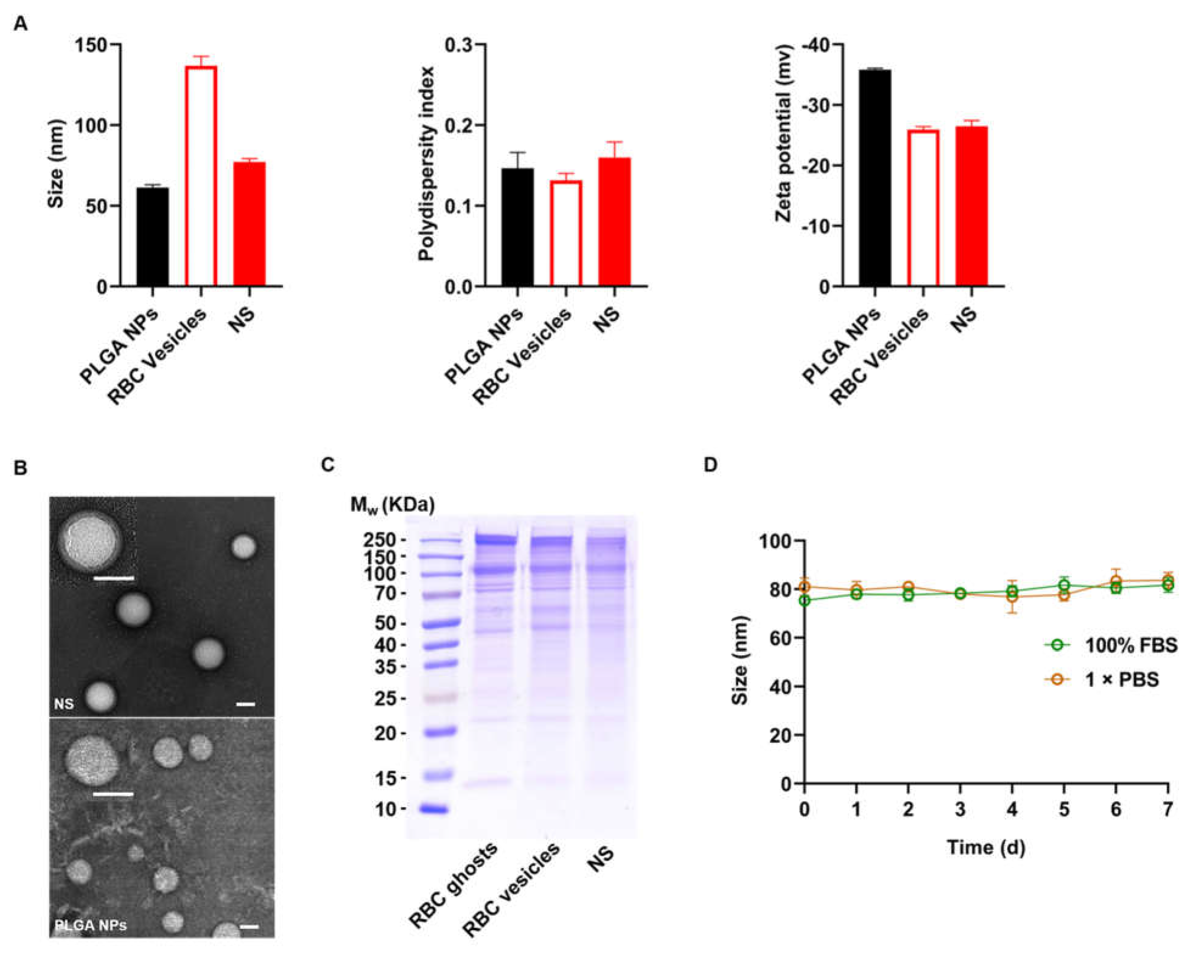 Ijms Free Full Text Biomimetic Nanosponges Enable The Detoxification Of Vibrio Vulnificus Hemolysin Html