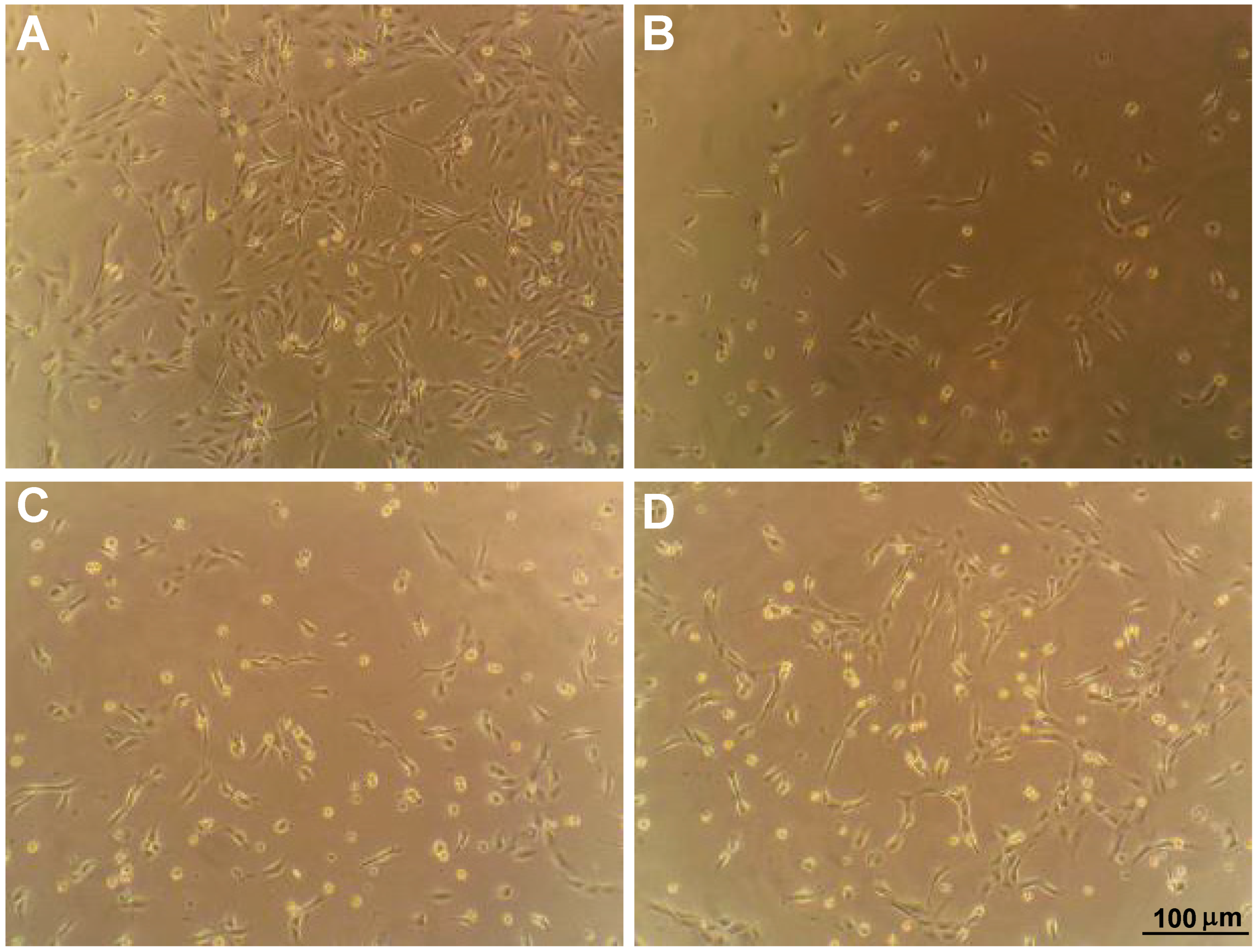 Ijms 23 07004 g001 Ijms 23 07004 g001