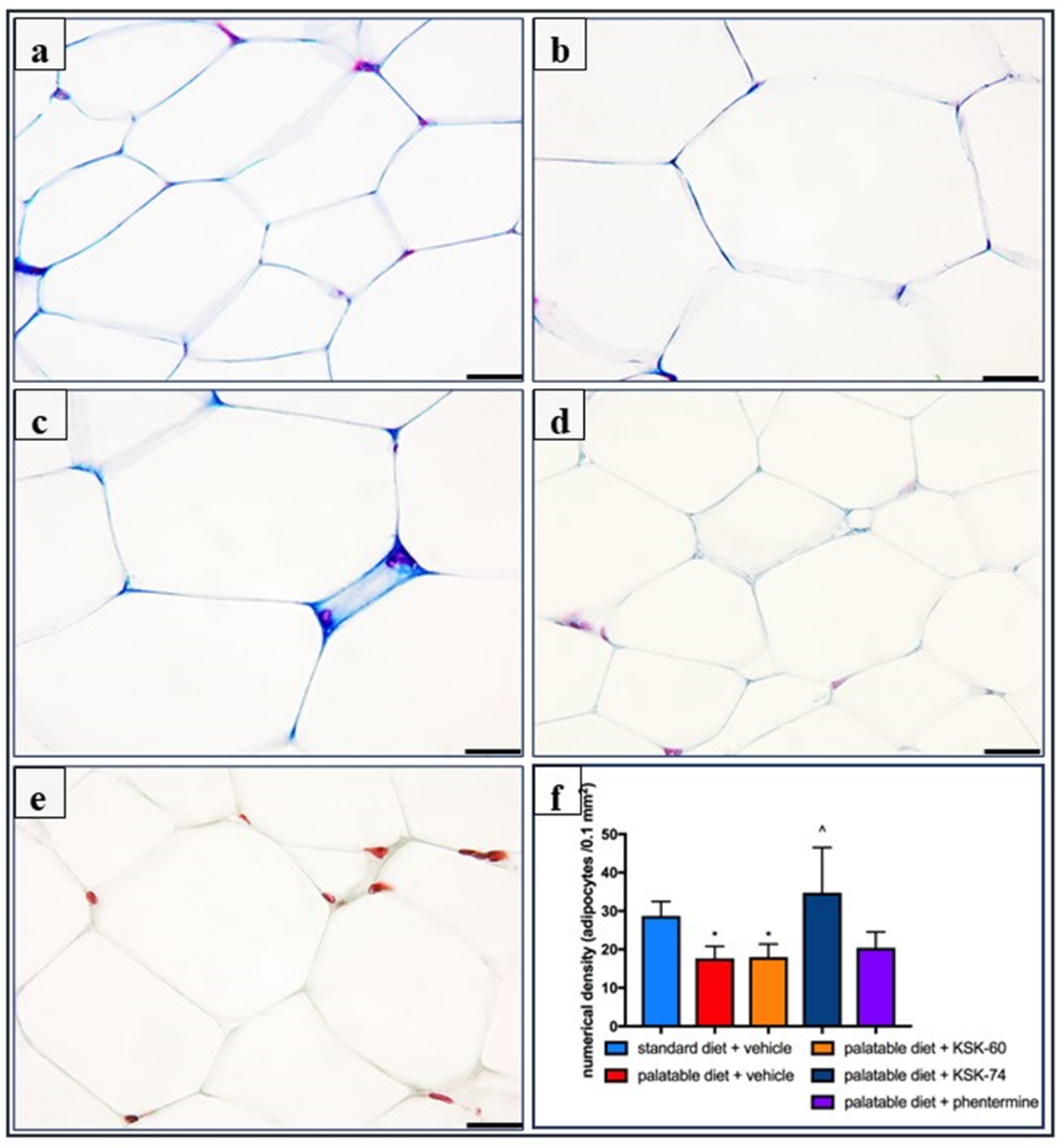 Ijms 23 07011 g007 550