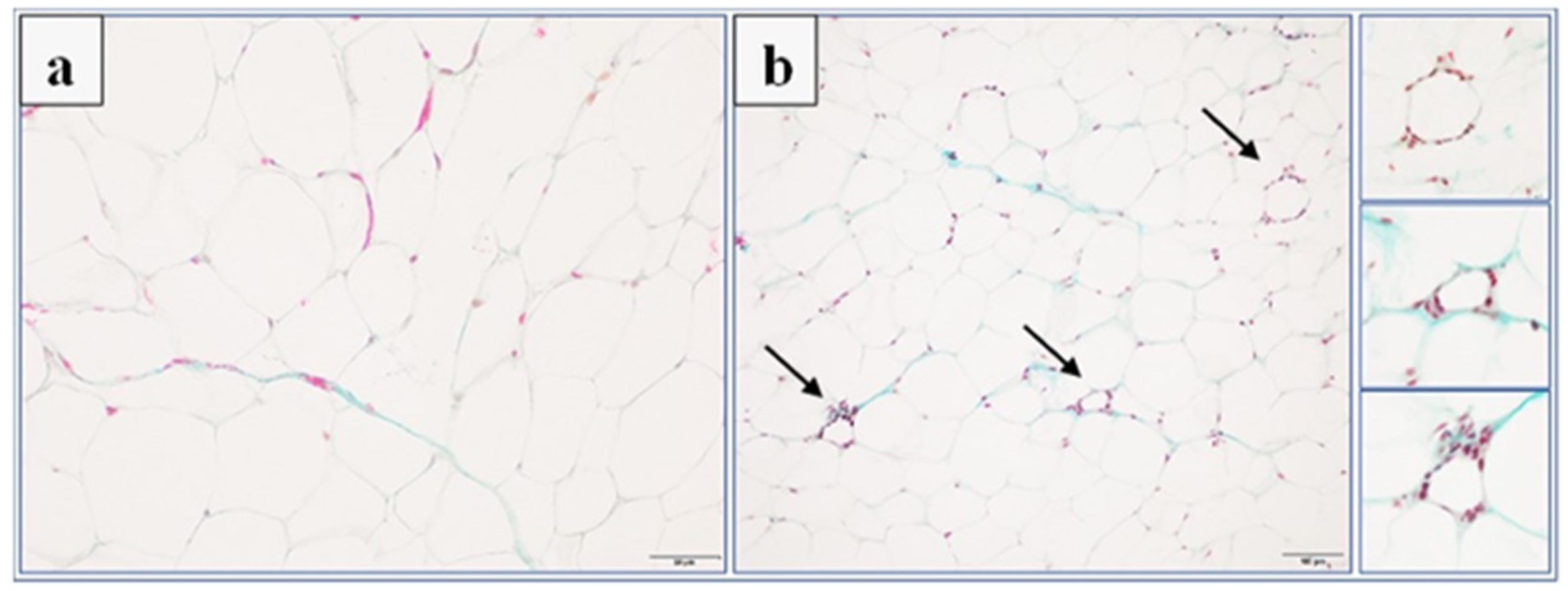 Ijms 23 07011 g009 550