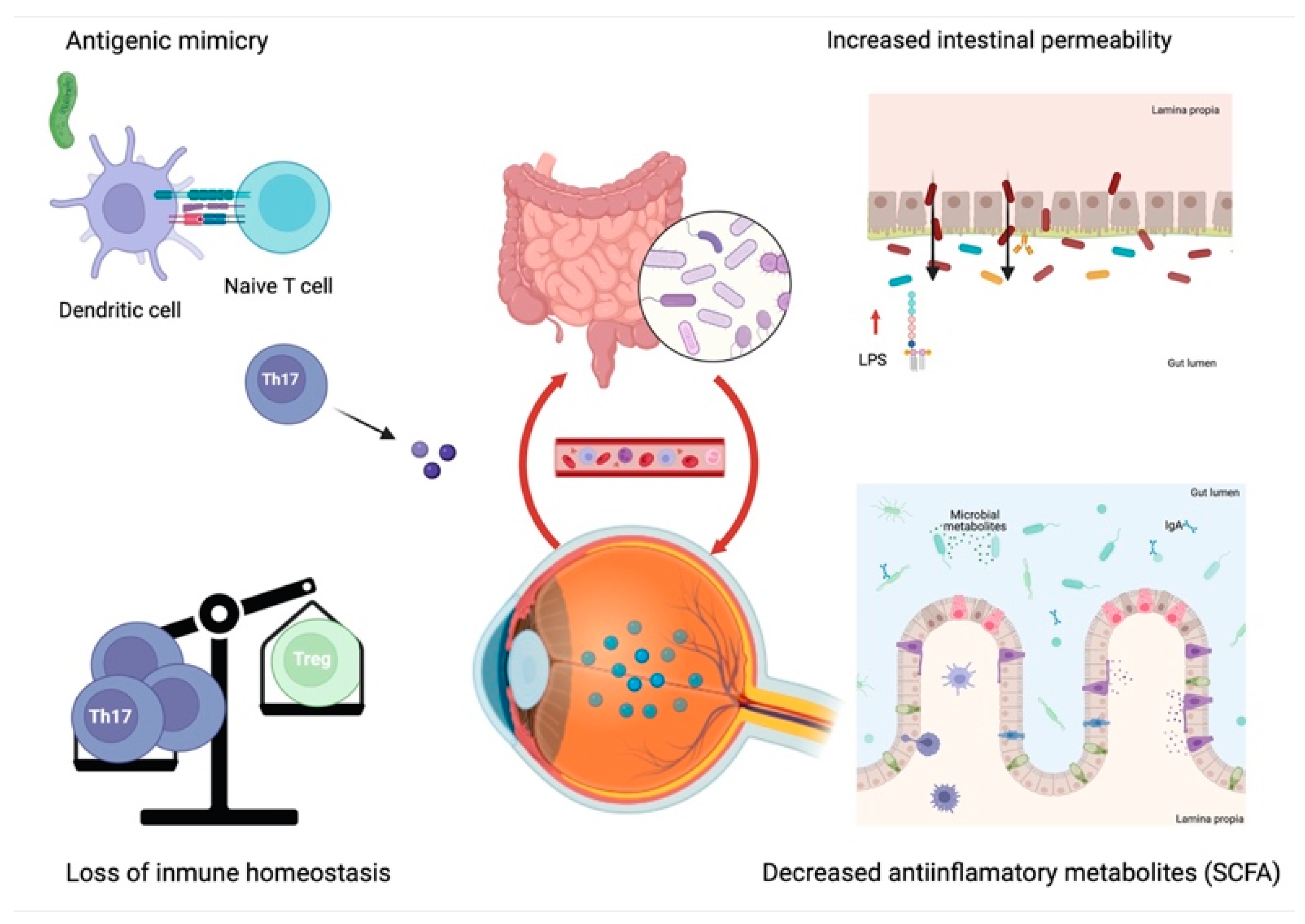 IJMS | Free Full-Text | Microbiome in Immune-Mediated Uveitis