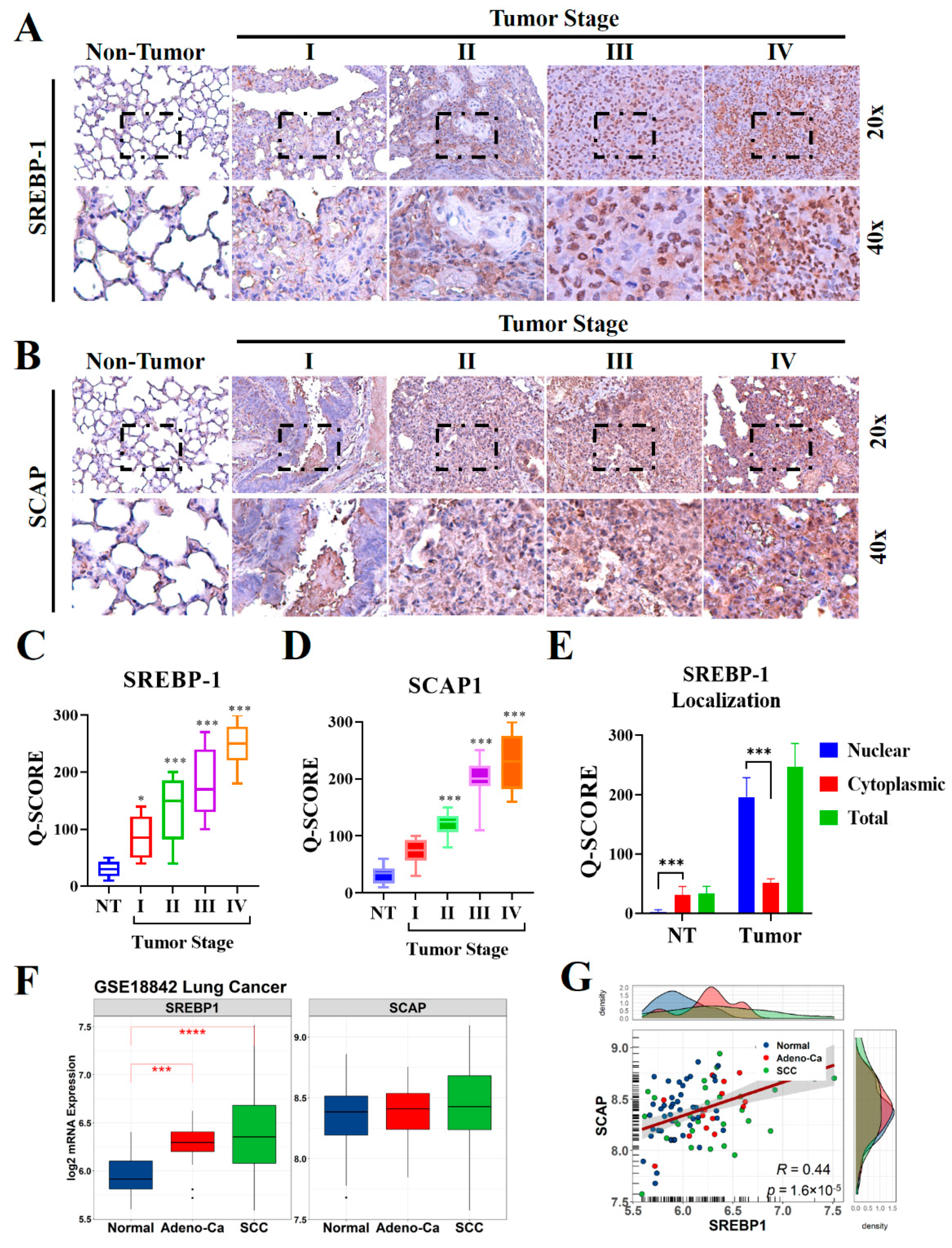 Targeting the SREBP-1/Hsa-Mir-497/SCAP/FASN Oncometabolic