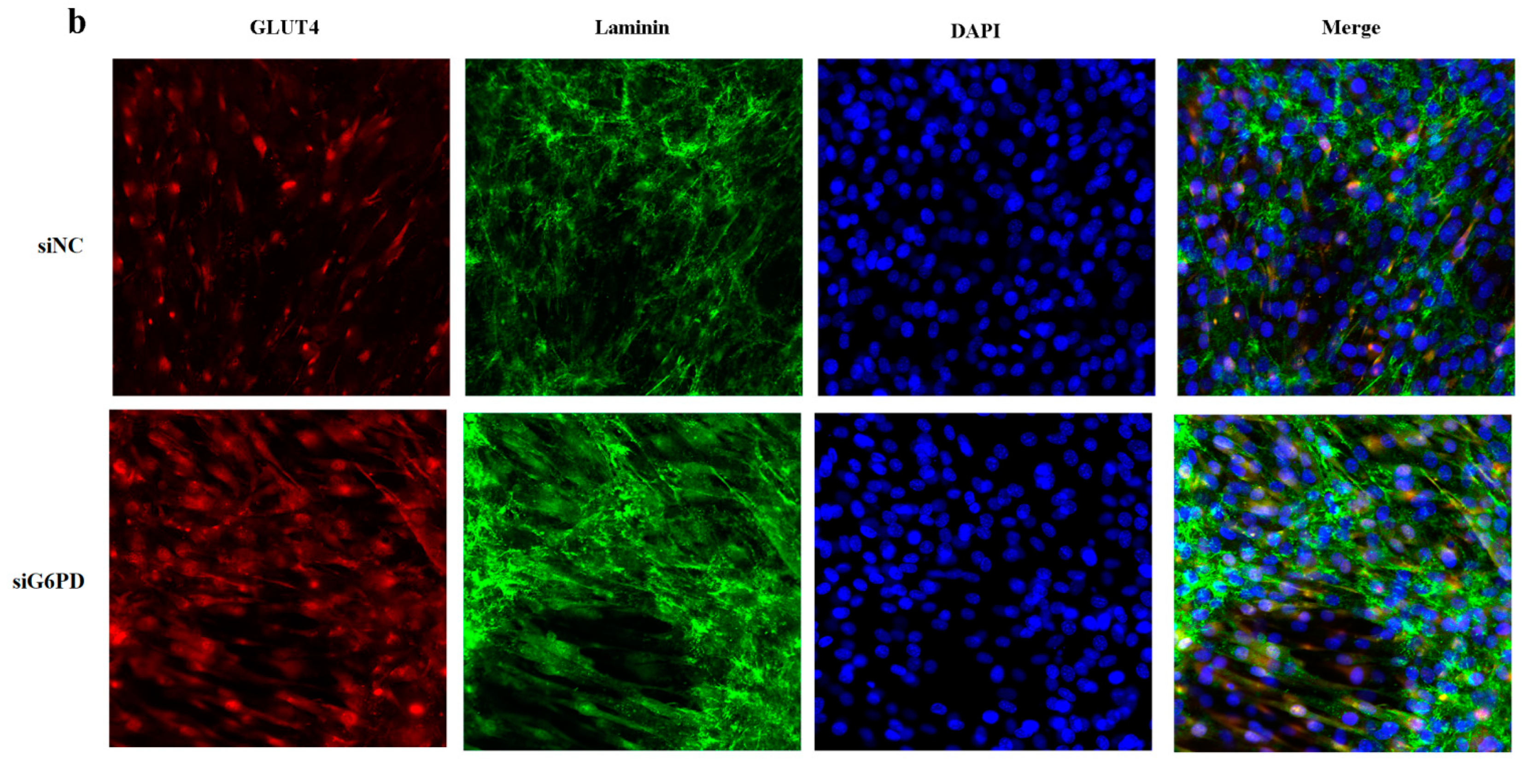 Ijms 23 07425 g003b 550