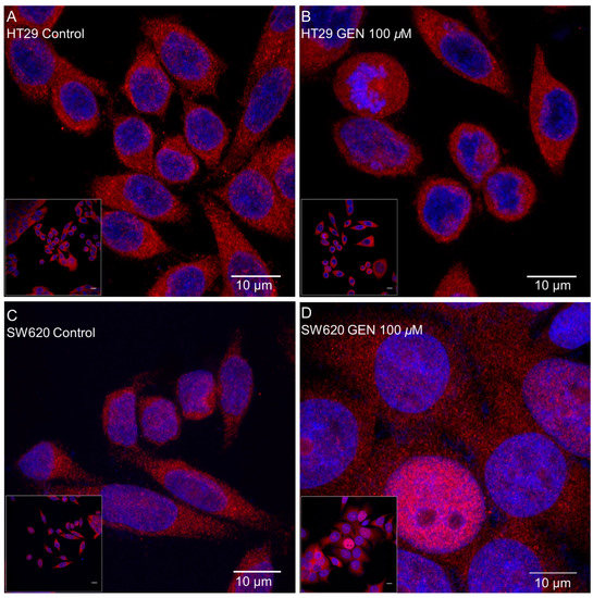 High Concentrations of Genistein Decrease Cell Viability Depending on ...