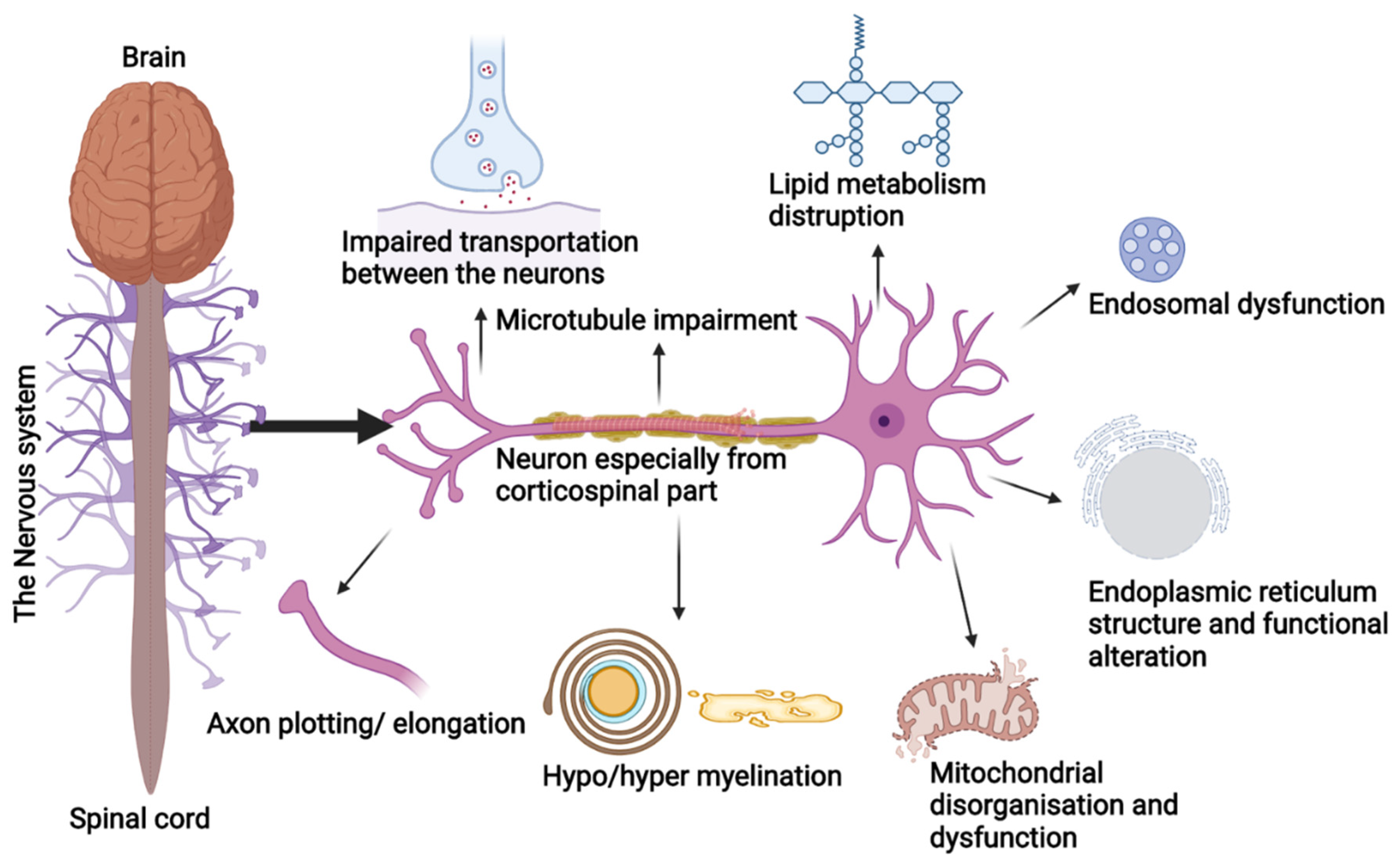 Hereditary Spastic Paraplegia Clinical genetic 55 OFF