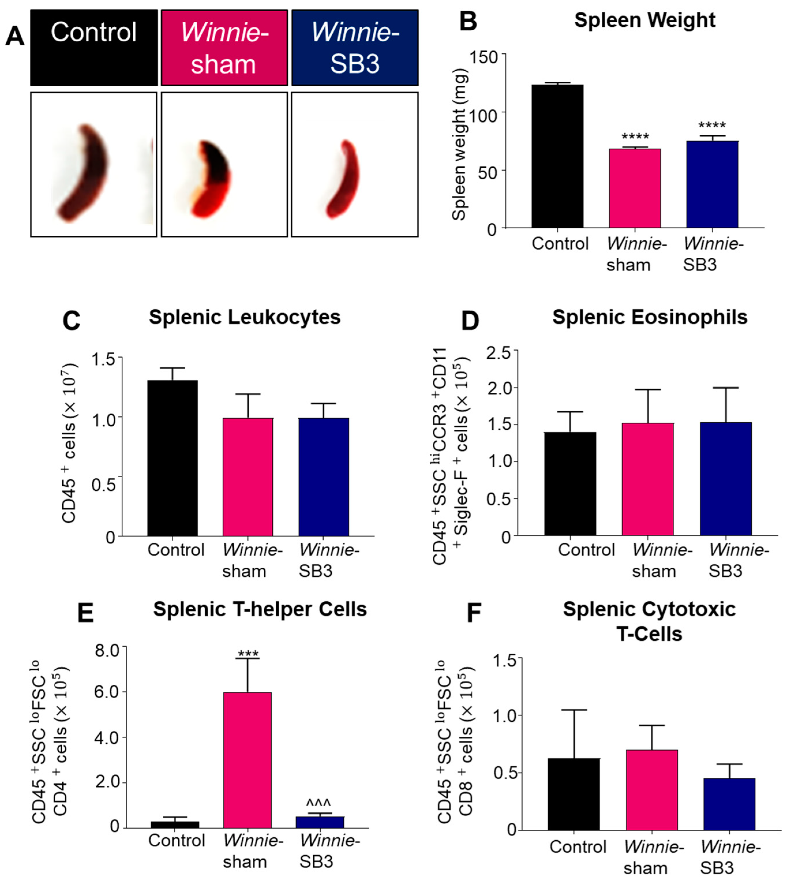 Ijms 23 07780 g004 Ijms 23 07780 g004