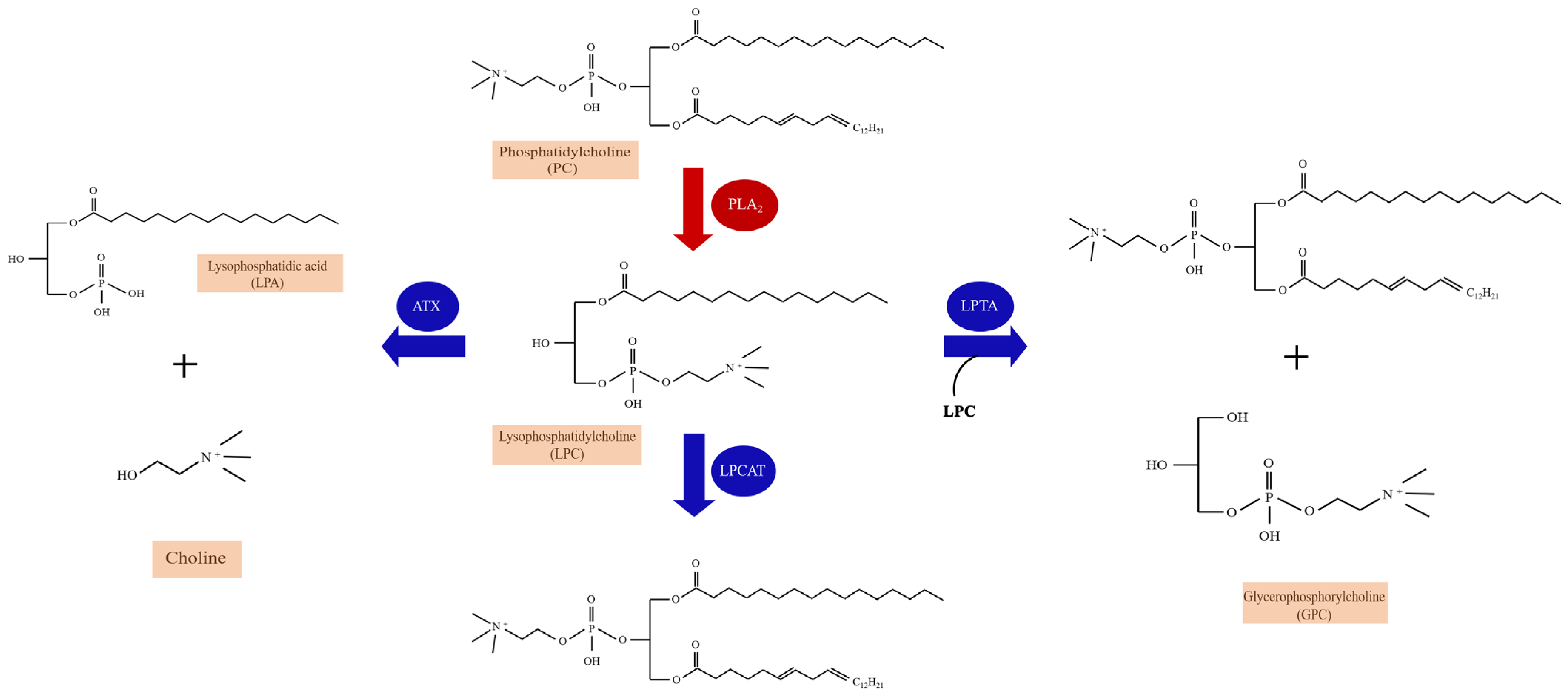 Lysophosphatidylcholine: Potential Target for the Treatment of Chronic Pain Lysophosphatidylcholine: Potential Target for the Treatment of Chronic Pain