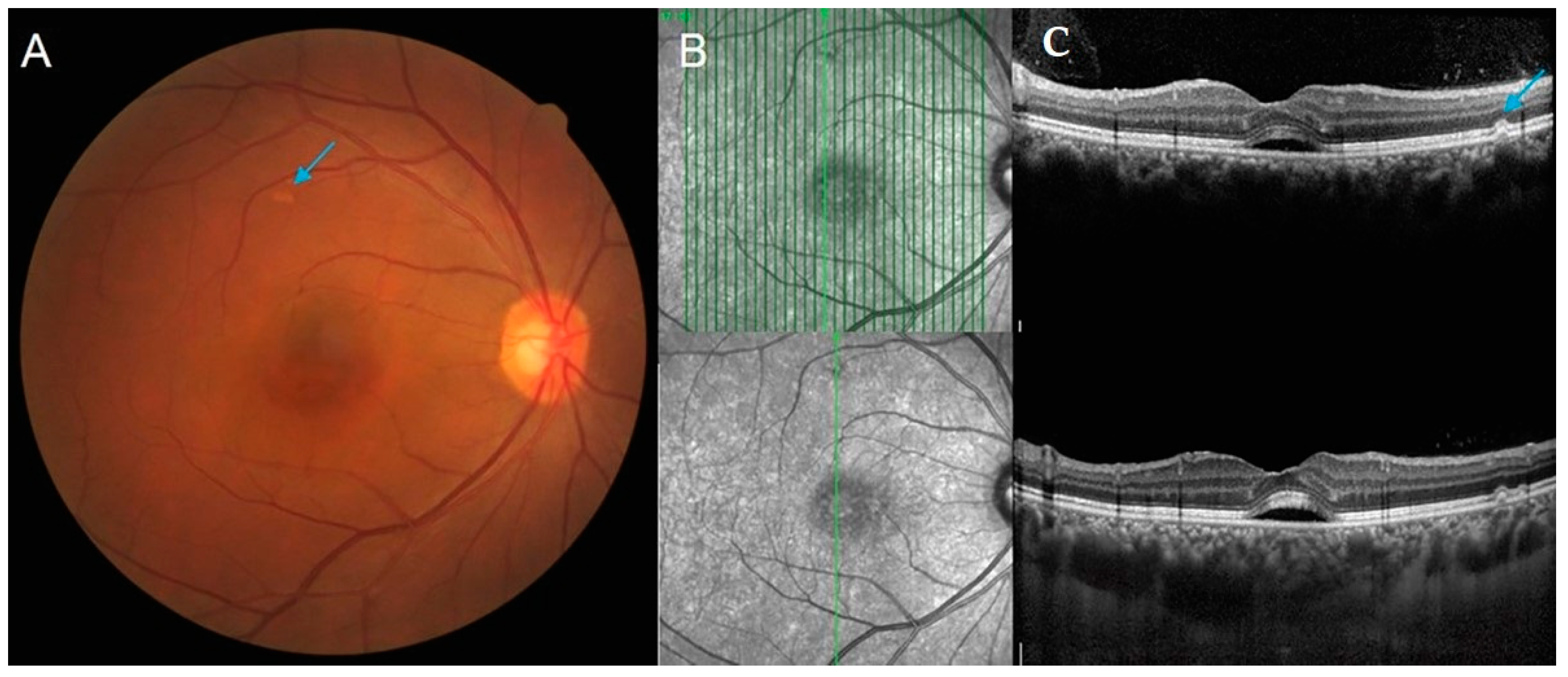 Ijms 23 08353 g001 550