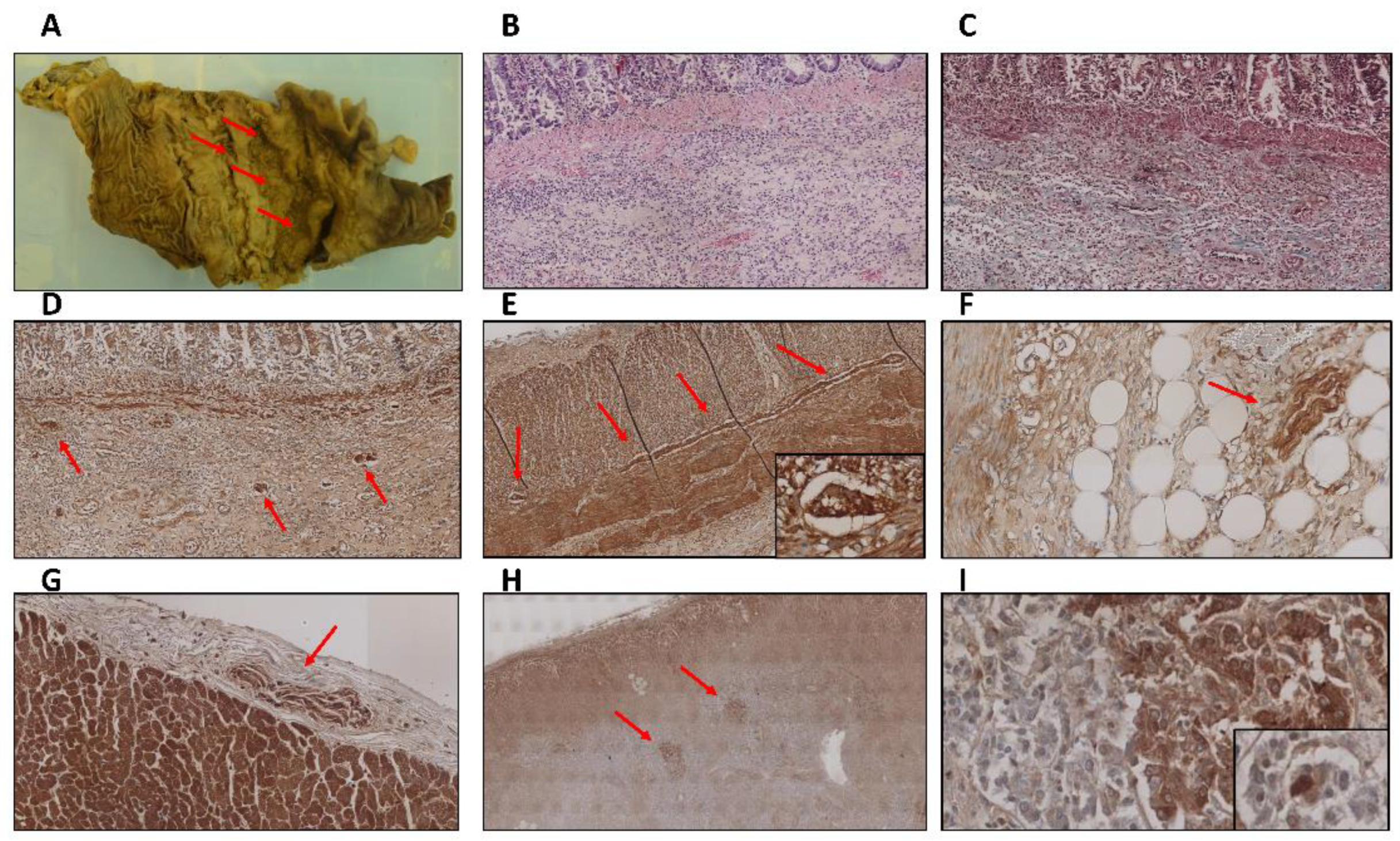 Ijms 23 08376 g001 550