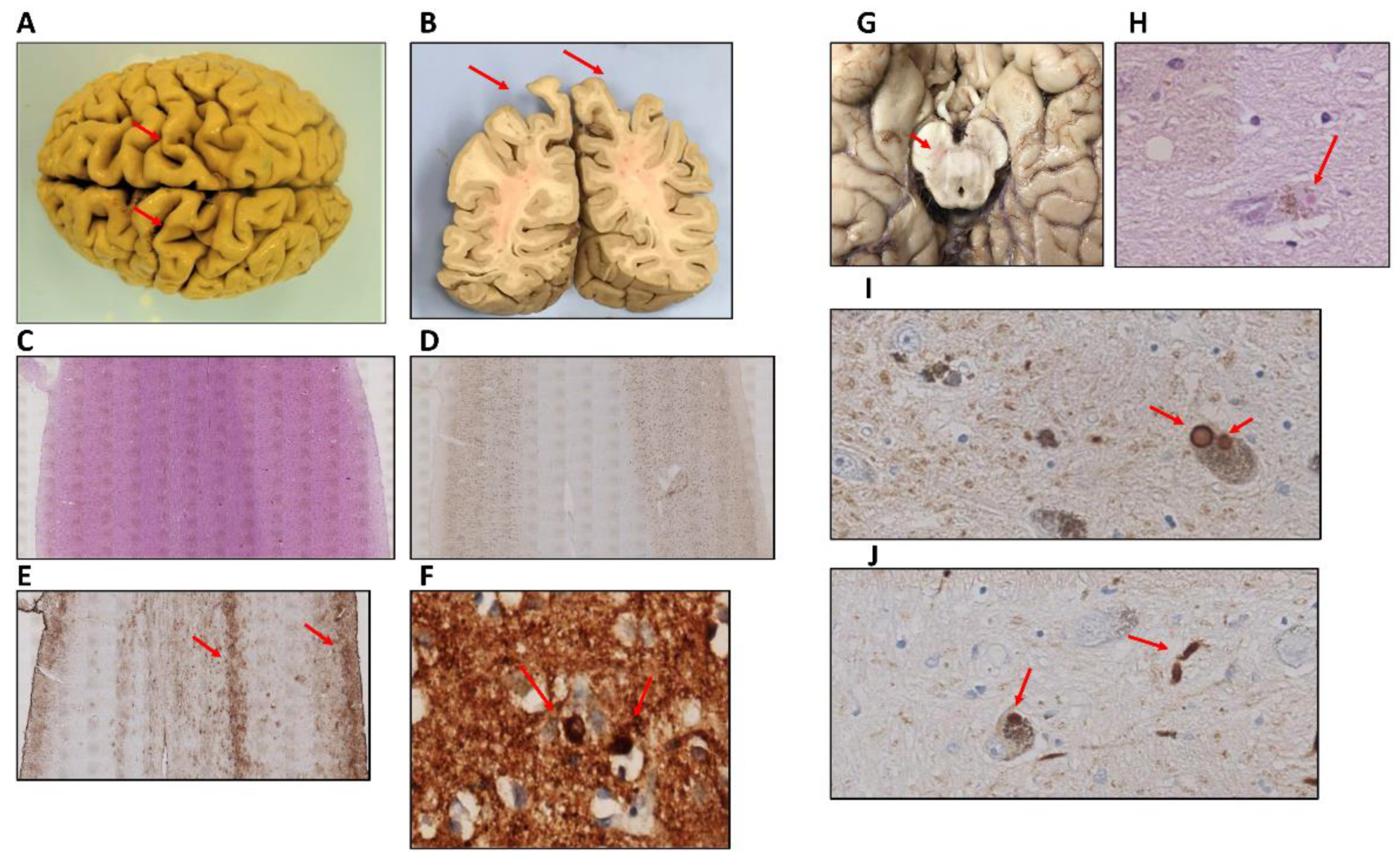 Ijms 23 08376 g002 550