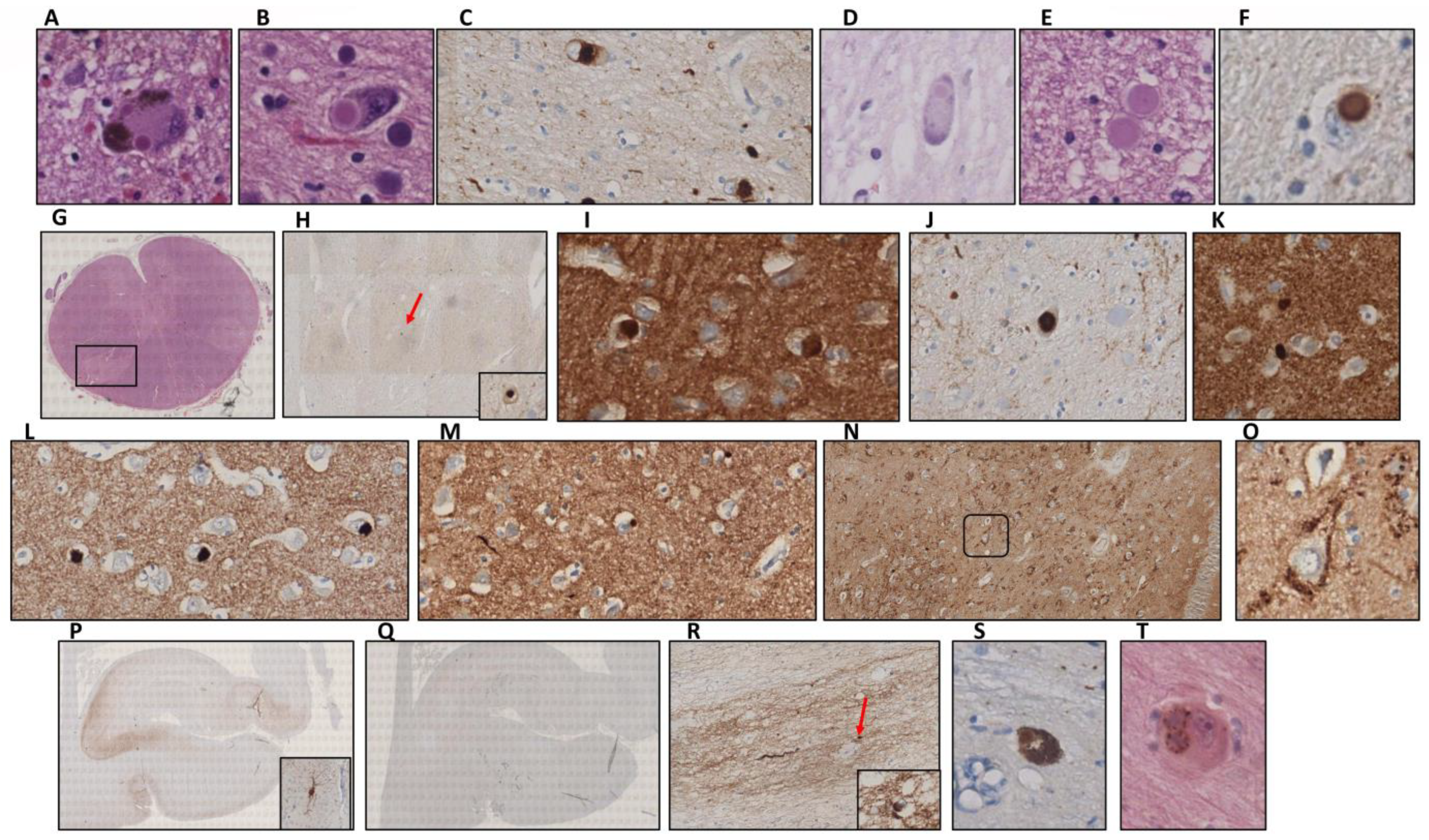 Ijms 23 08376 g004 550