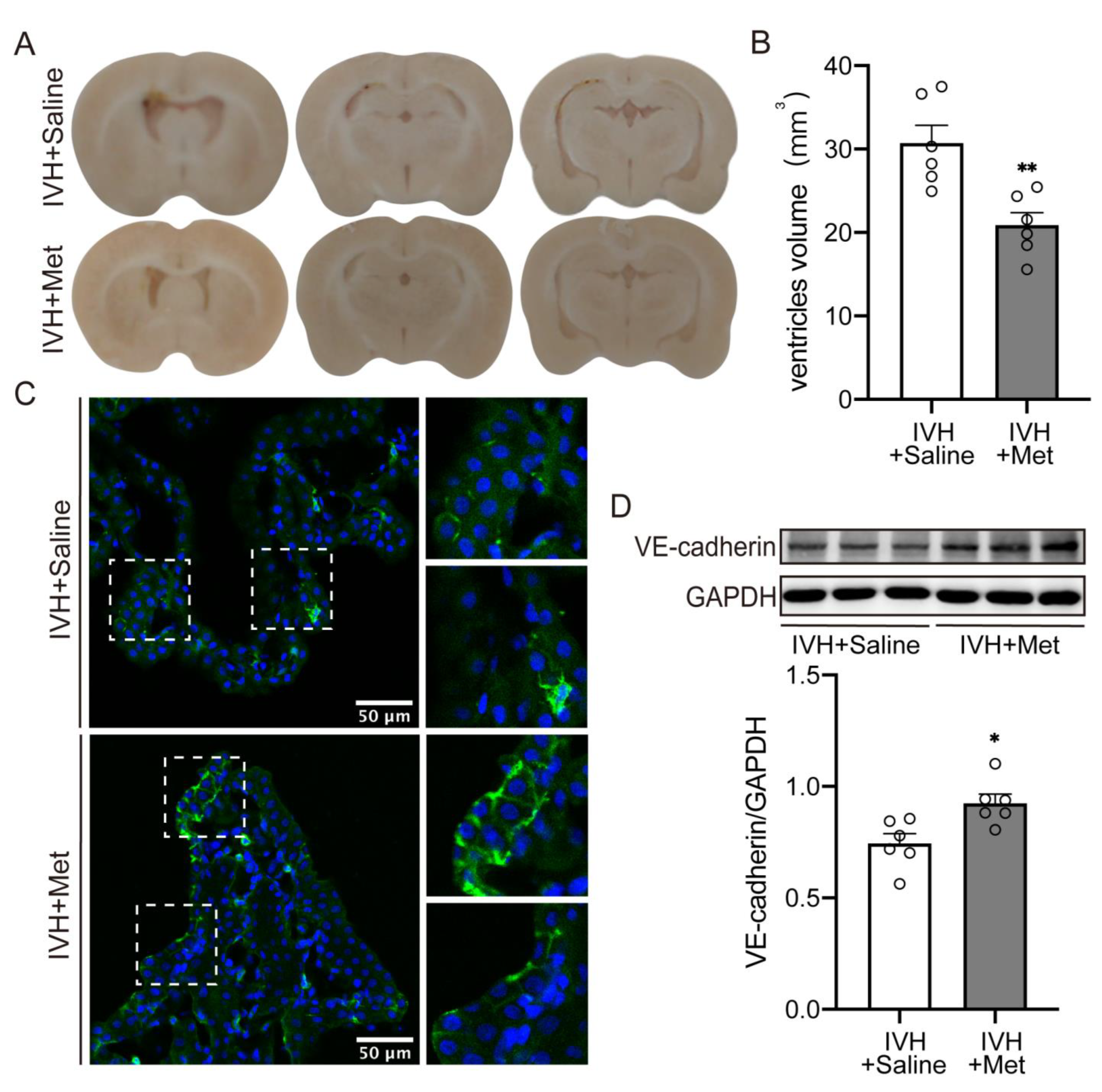 Metformin Preserves VE–Cadherin in Choroid Plexus and Attenuates