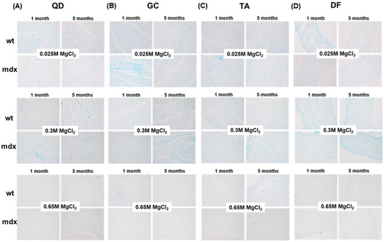 Characterisation of Progressive Skeletal Muscle Fibrosis in the Mdx ...